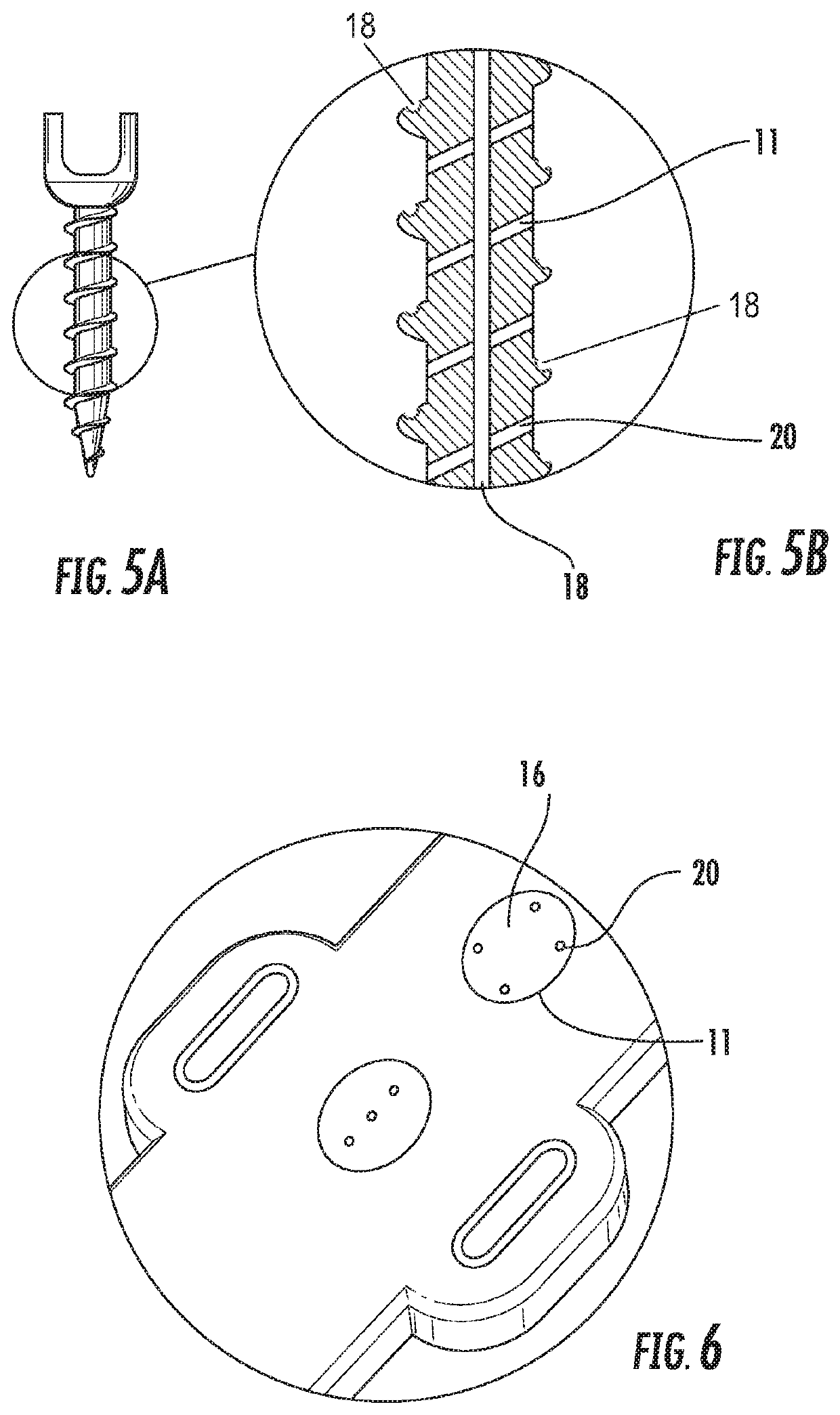 Collagen permeated medical implants