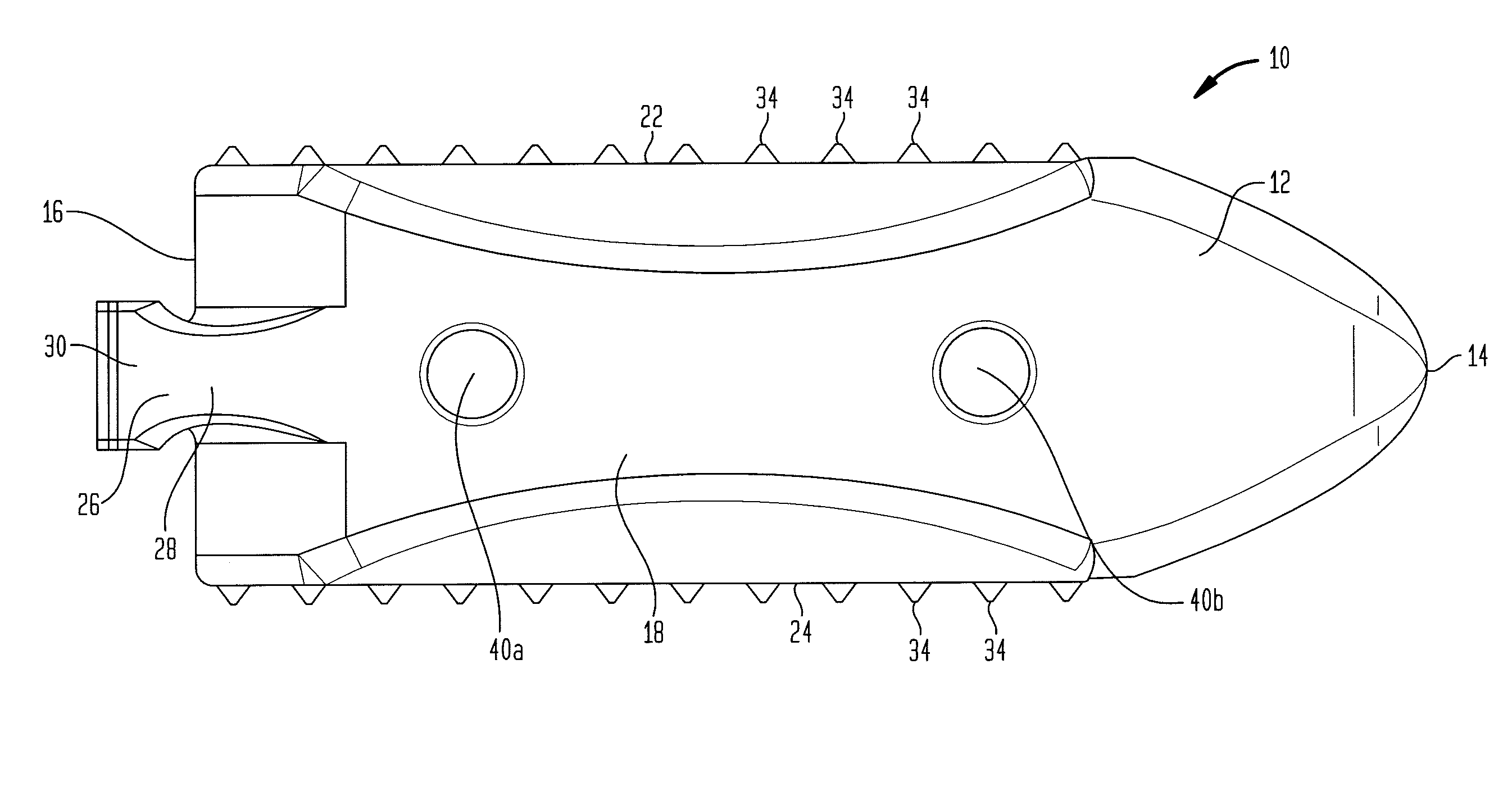 Surgical implant with guiding rail