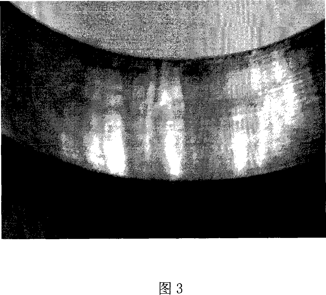 High-temperature long-life self-lubricating wearproof alloy material