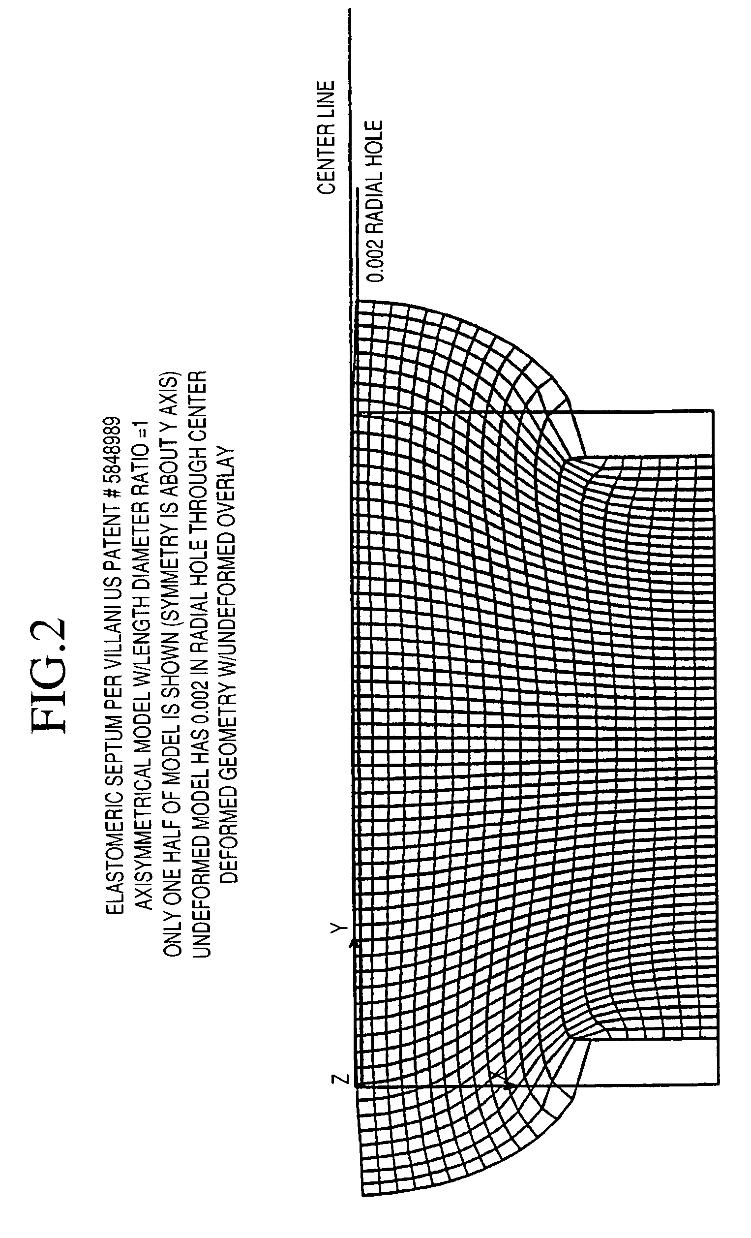 Implantable vascular access device