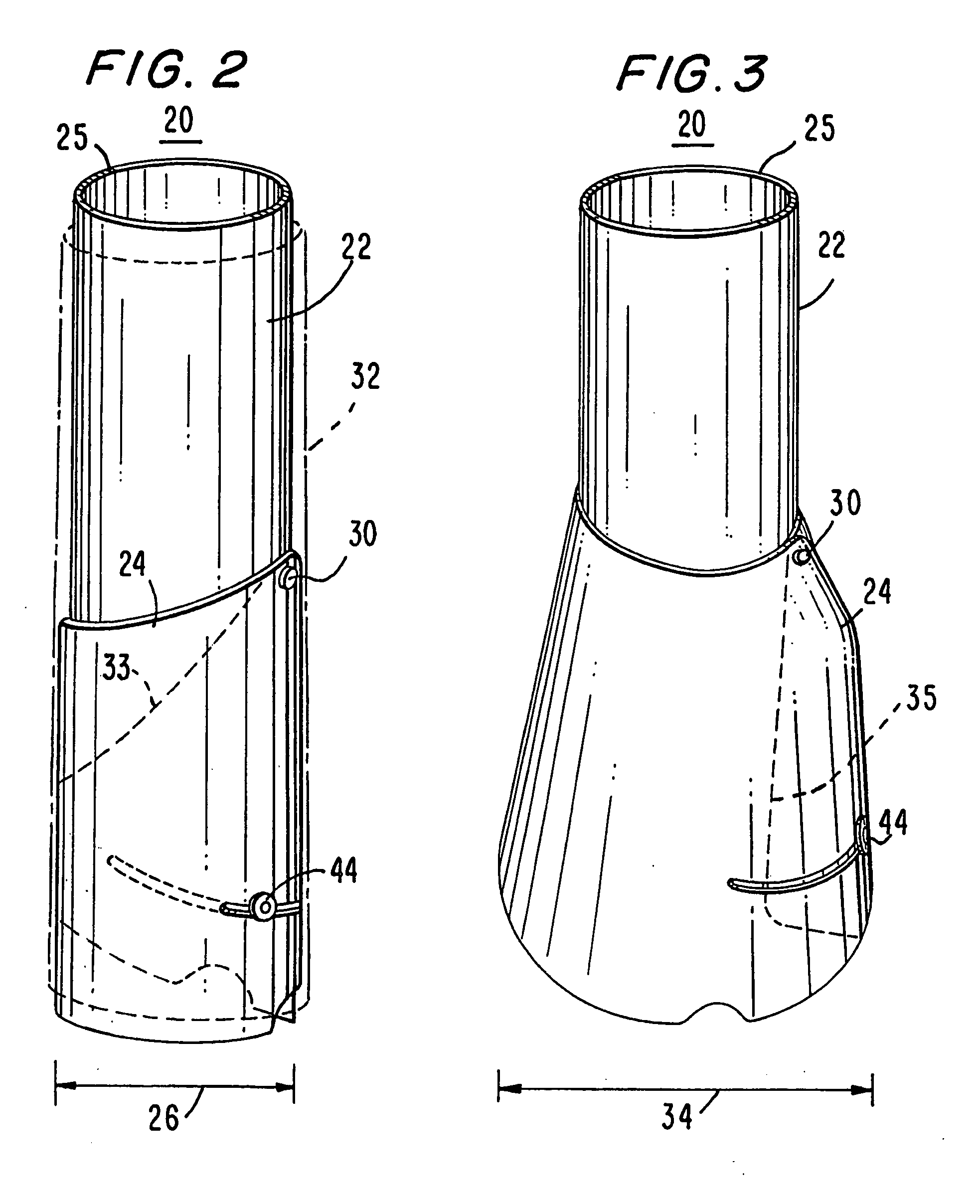 Methods and apparatus for stabilizing the spine through an access device