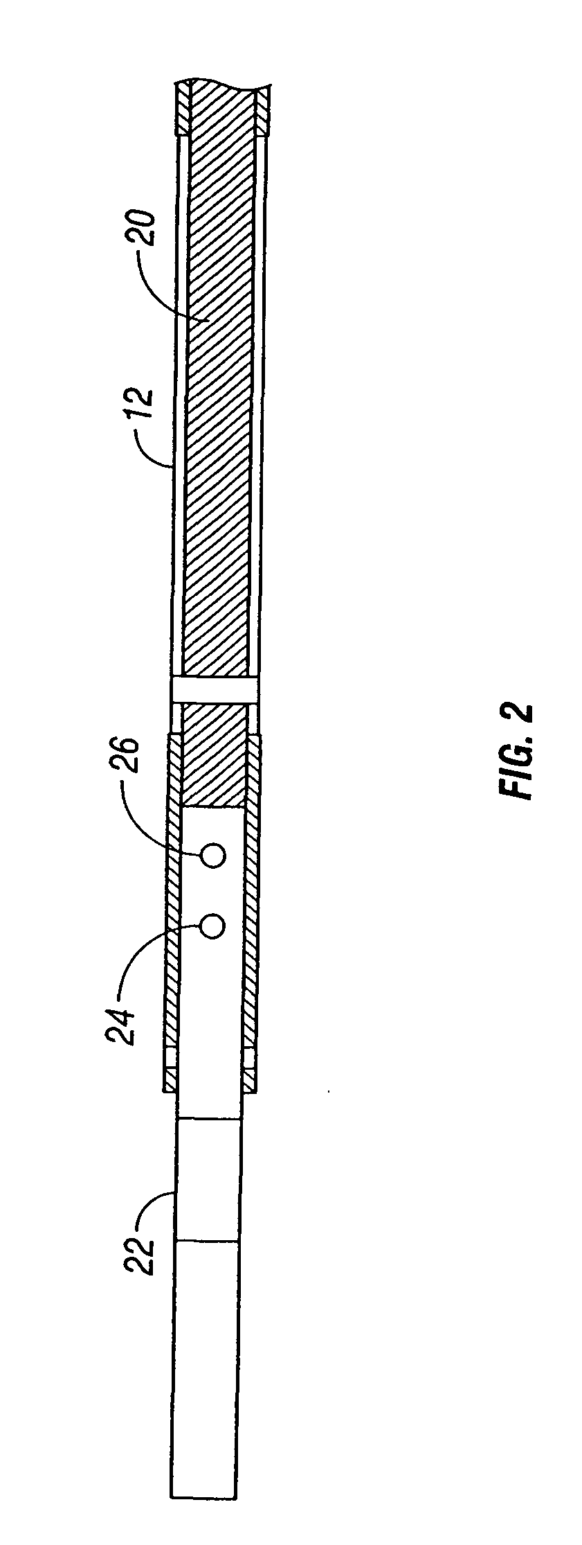 Apparatus for dimensioning circumference of cavity for introduction of a prosthetic implant