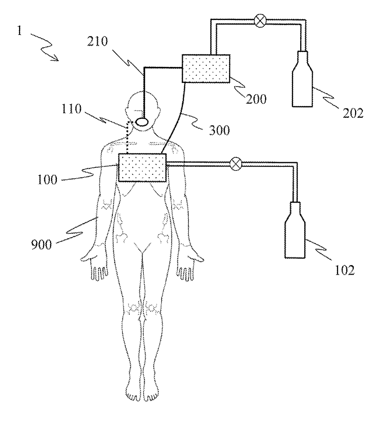 Cardiopulmonary resuscitation system, cardiopulmonary resuscitation device, and artificial respirator