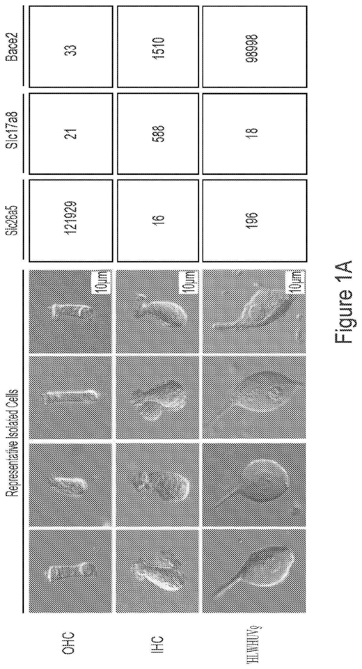 Methods of treating genetic hearing loss