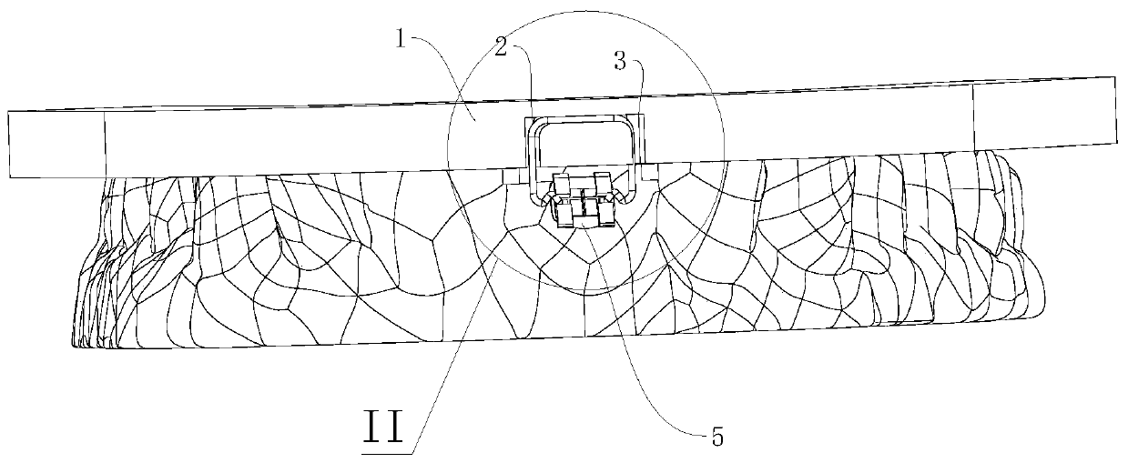 Adaptive Indirect Bracket Adhesive Bracket