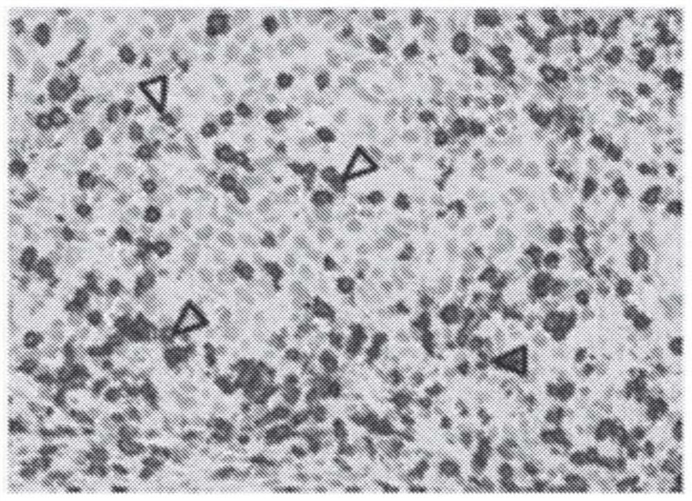 Cell localization features and combination therapy