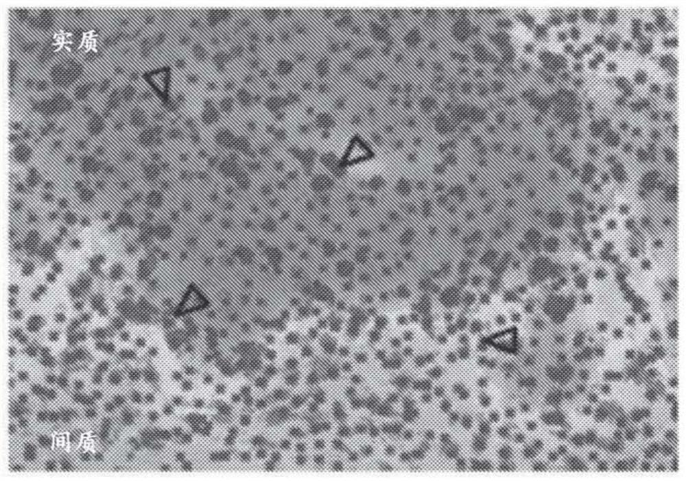 Cell localization features and combination therapy