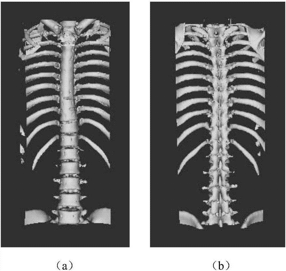 Automatic spine feature point recognition method based on Gauss curvature flow