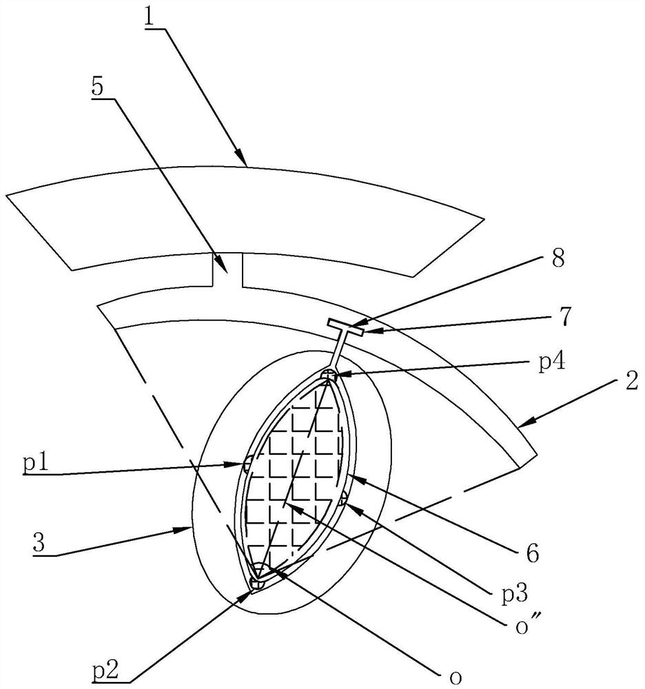 A positioning guide plate for extraction of embedded supernumerary teeth in anterior region and its manufacturing method