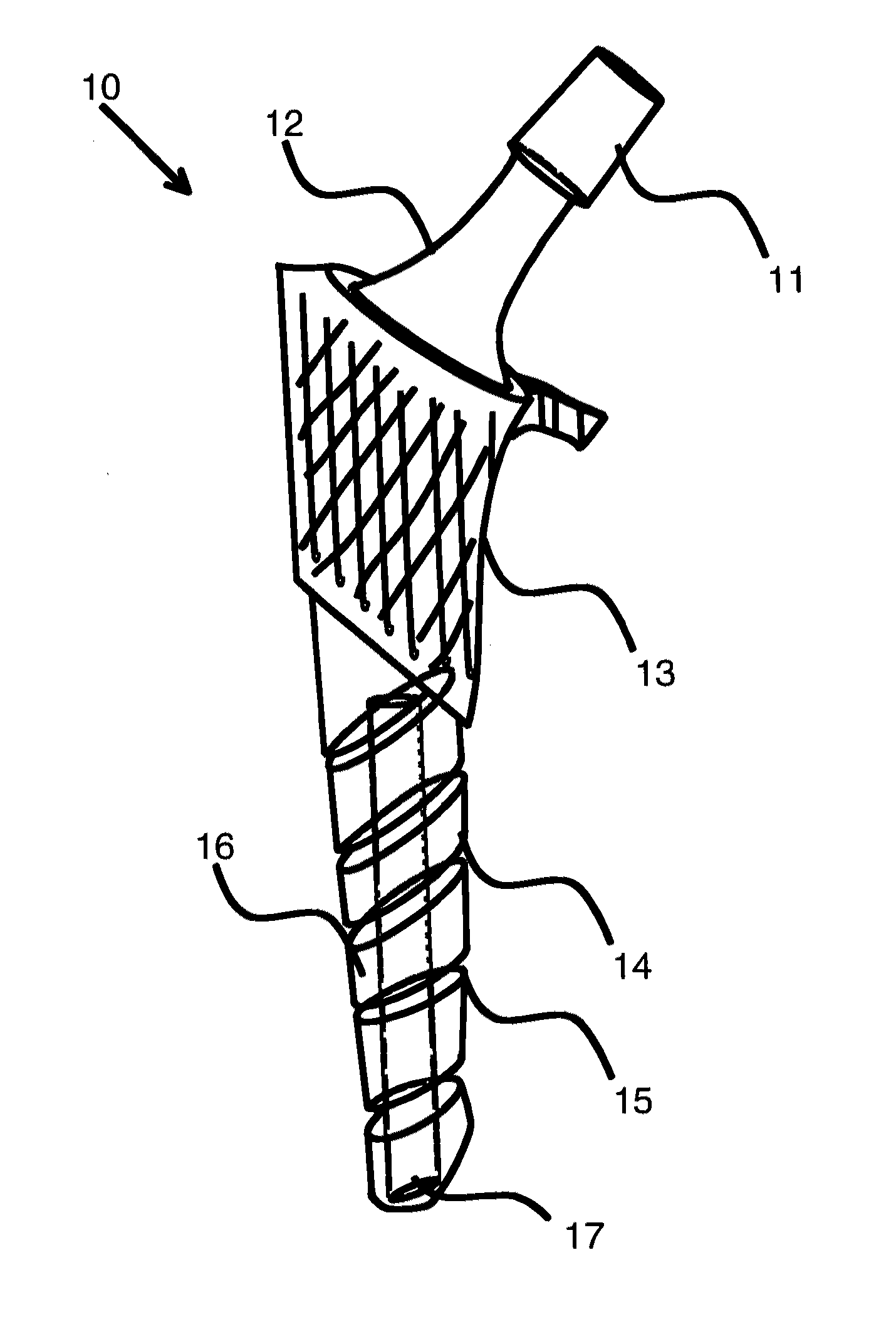 Load bearing implants