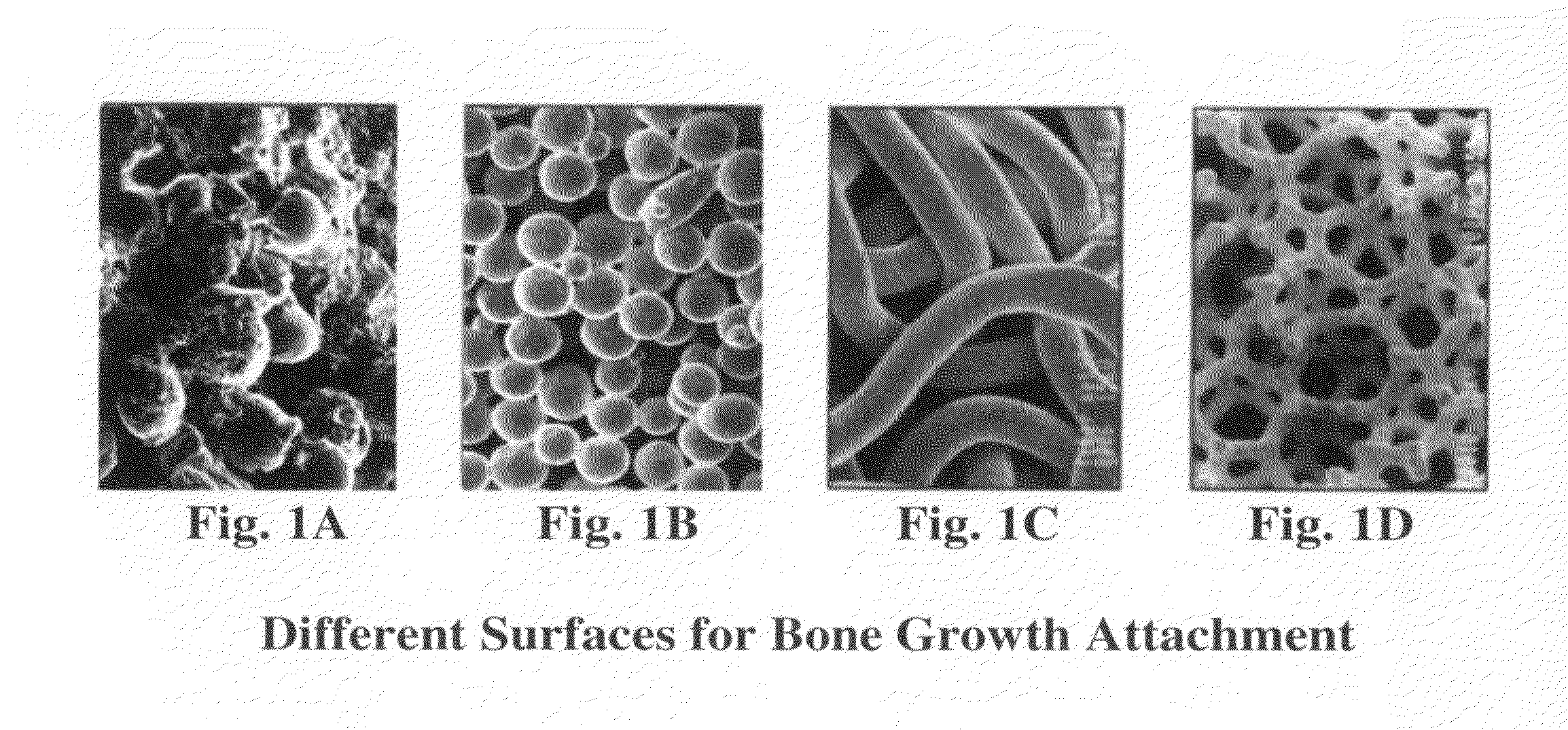 Load bearing implants