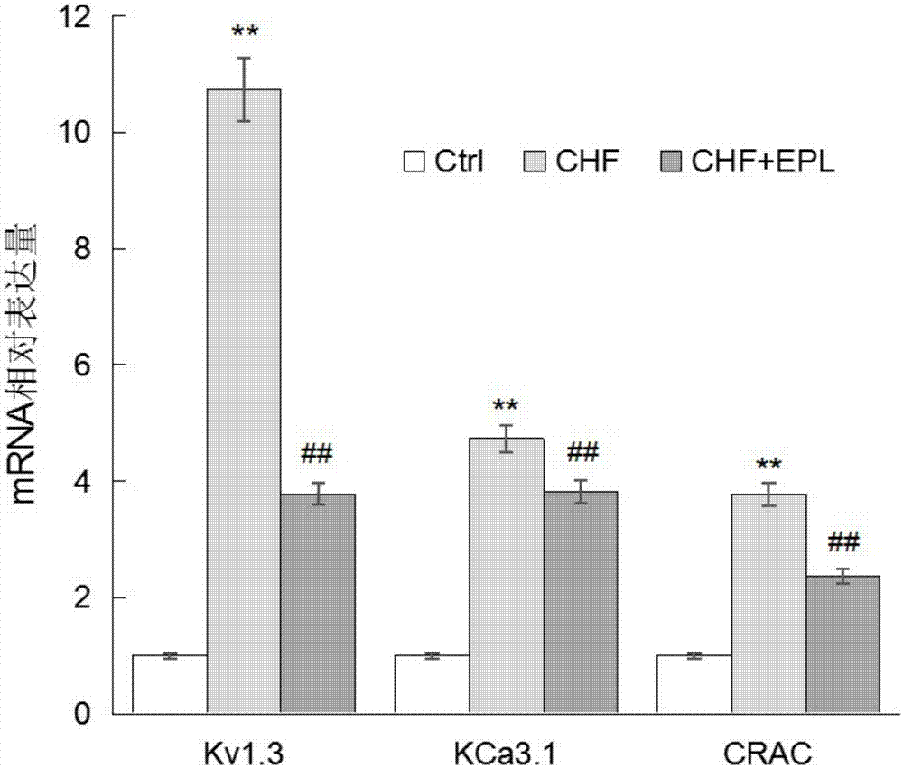 Inhibiting effect of eplerenone for activation/proliferation of helper T cells of chronic heart failure patients