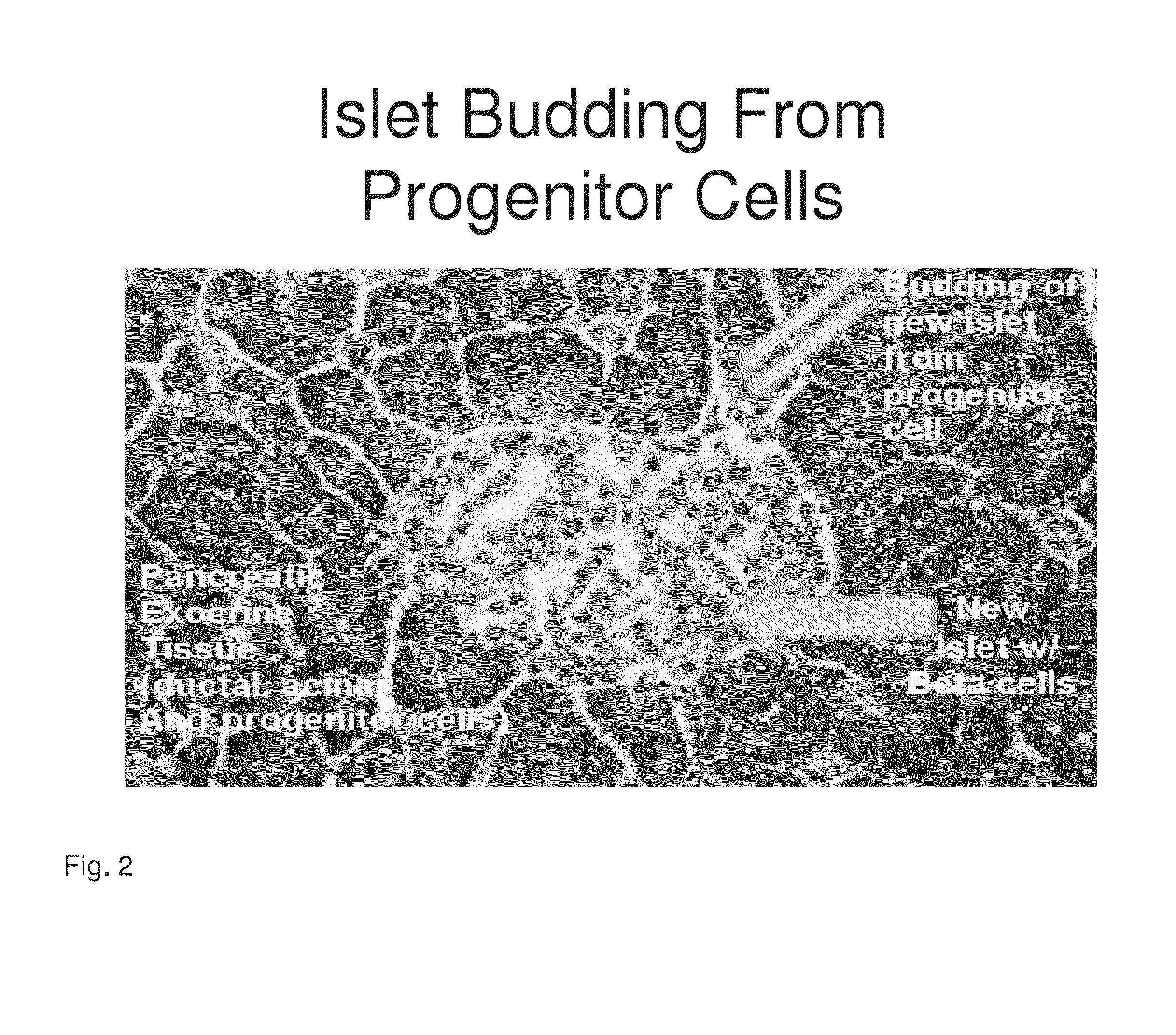 Generation of new pancreatic beta cells