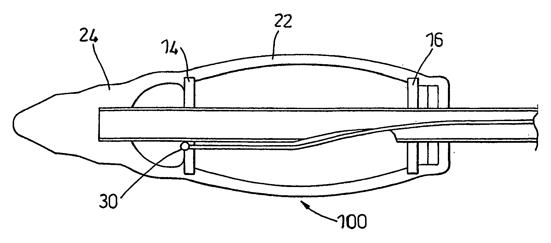 Dilation device