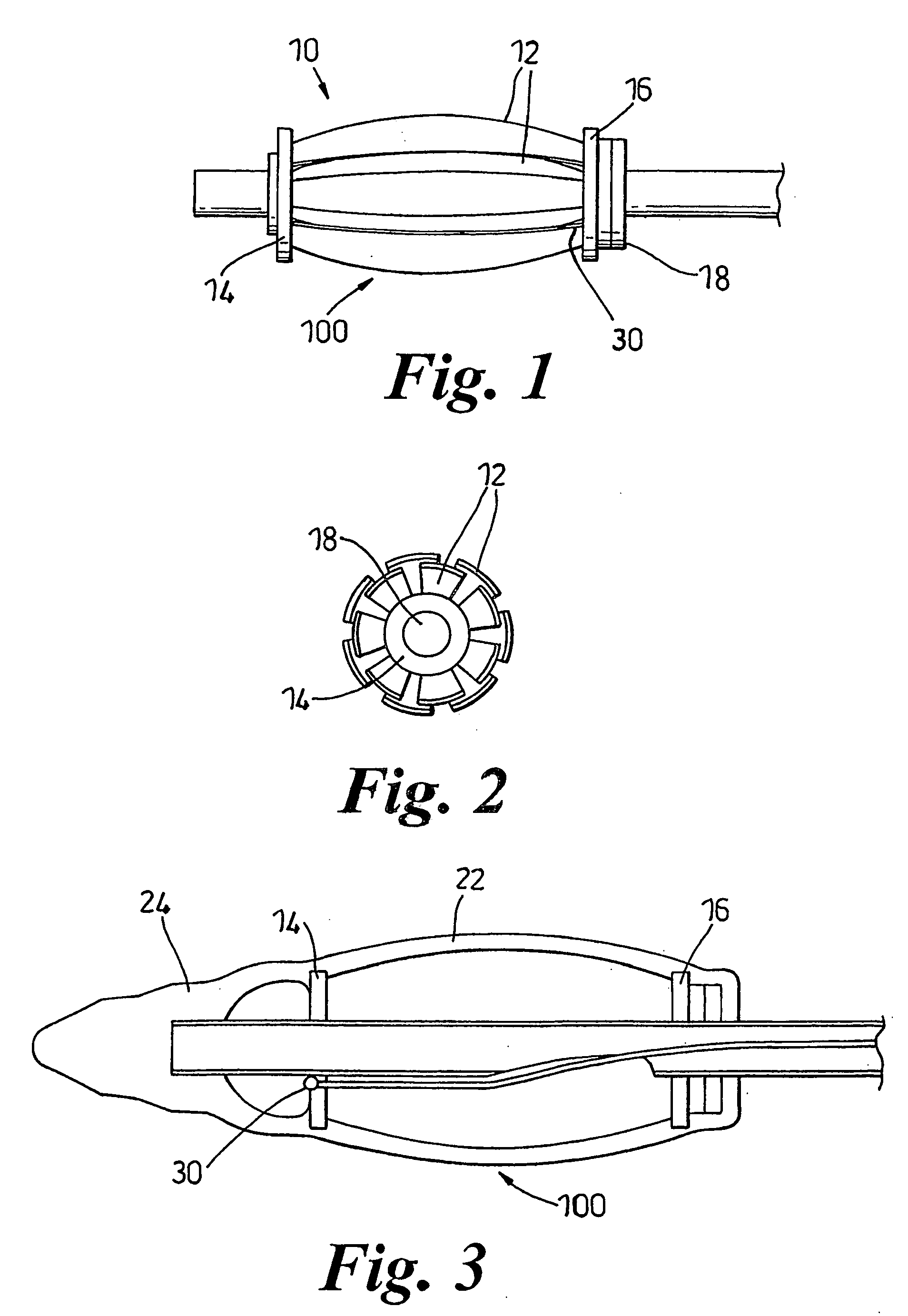 Dilation device