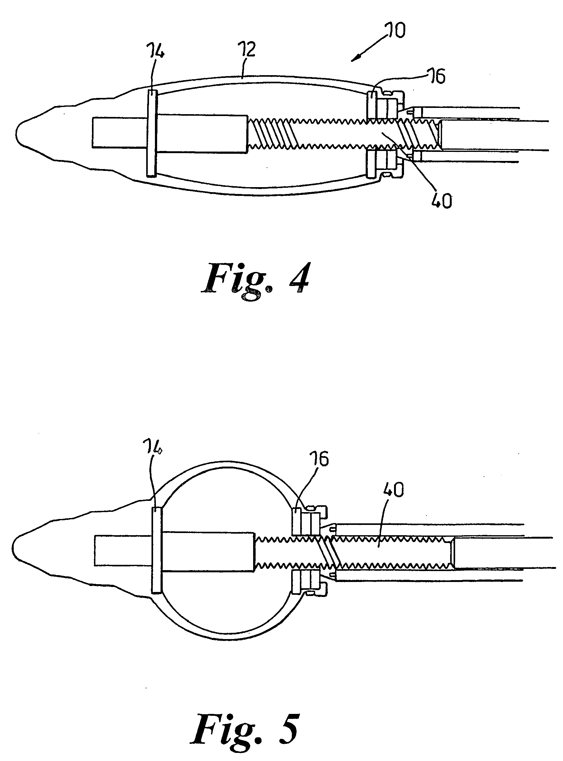 Dilation device