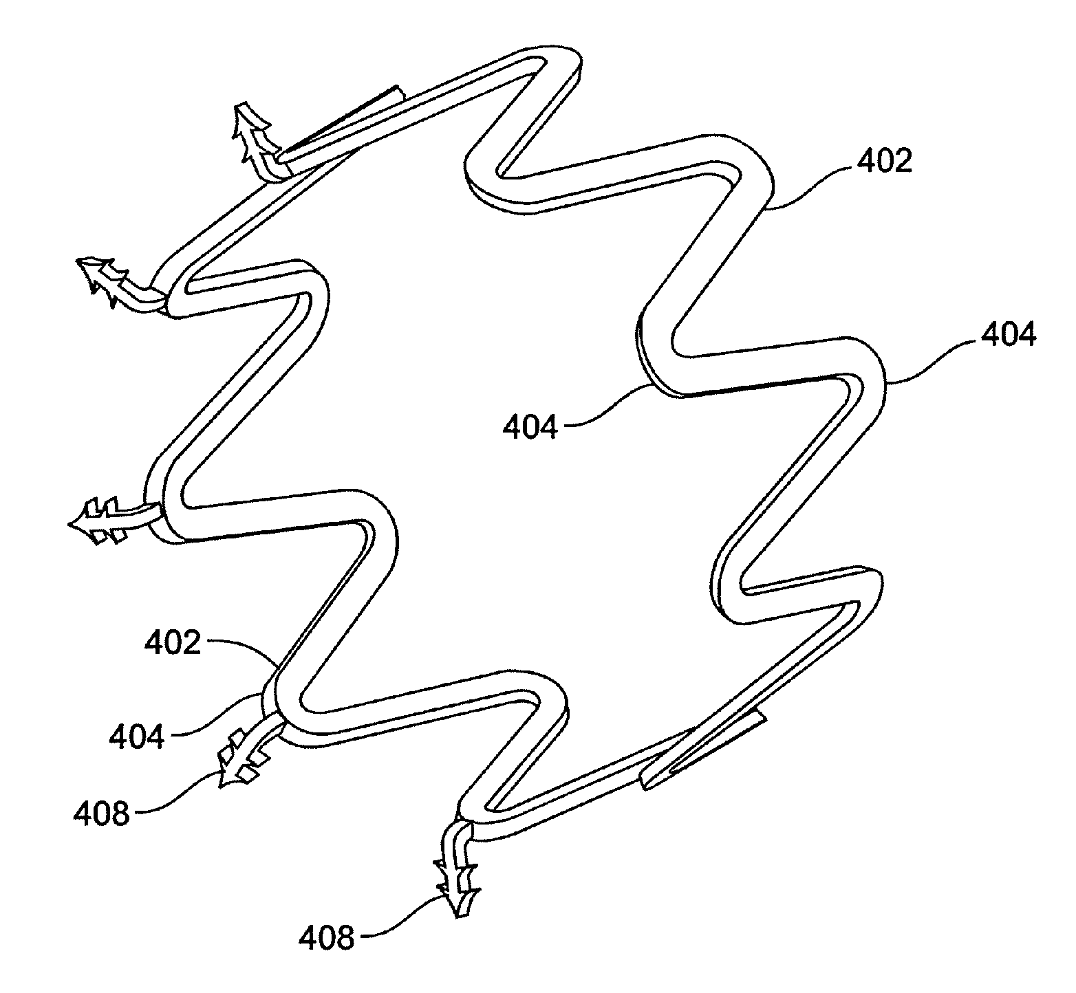 Cardiac valve annulus restraining device