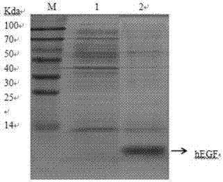 Human epidermal growth factor hEGF gene optimization sequence, method for preparing same and application of human epidermal growth factor hEGF gene optimization sequence