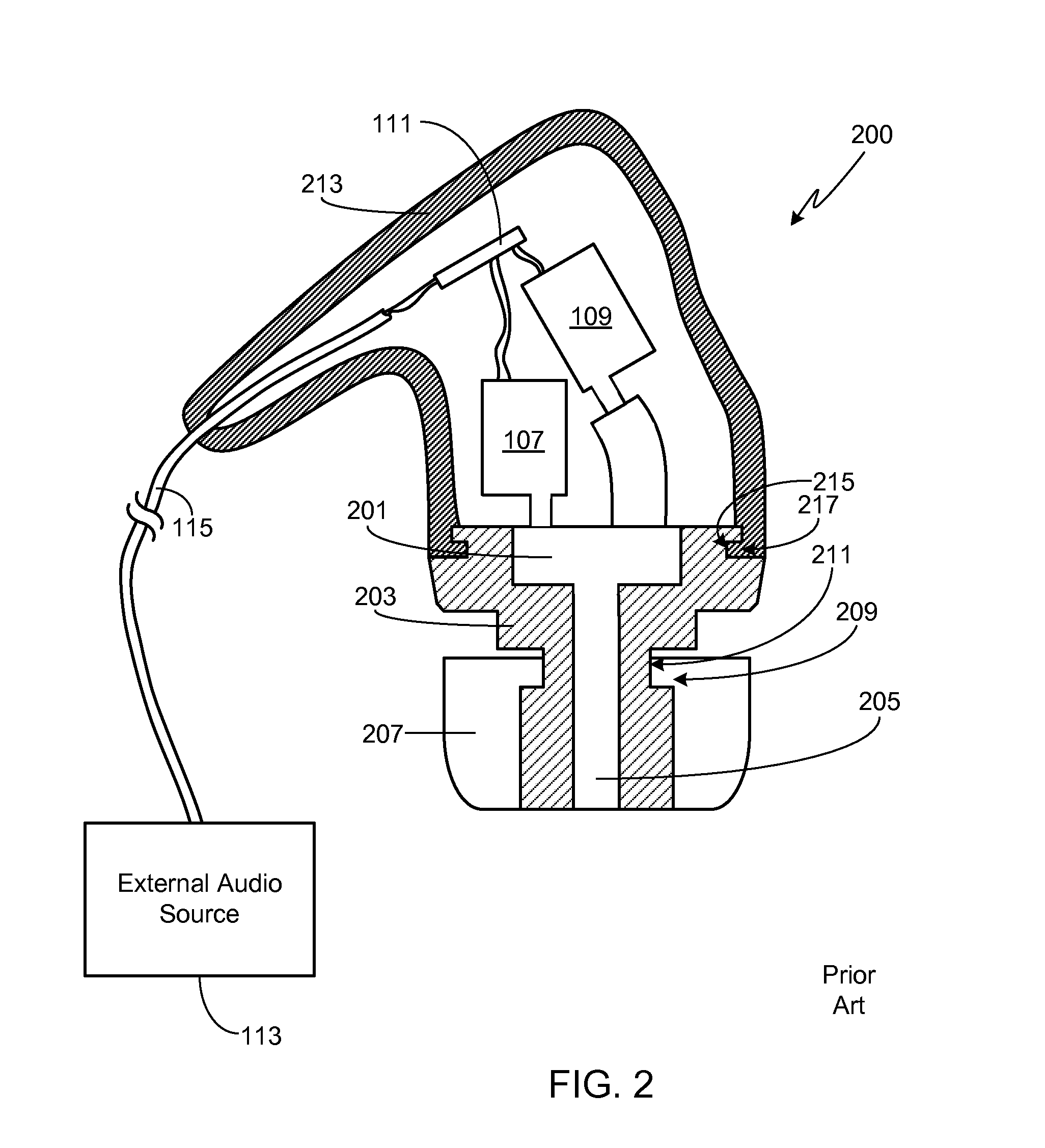 In-Ear Monitor with Concentric Sound Bore Configuration