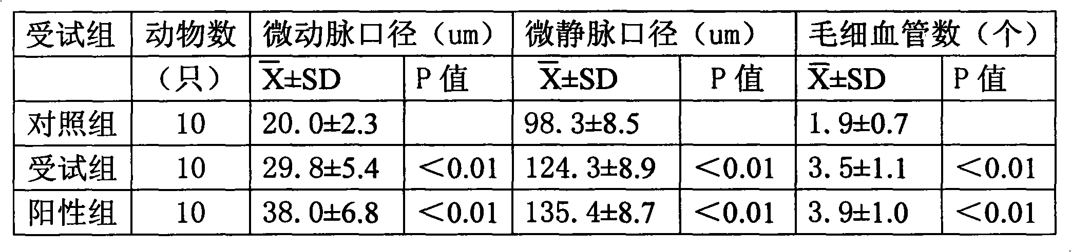 Traditional Chinese medicine combination for treating breast hyperplasia and preparation method thereof