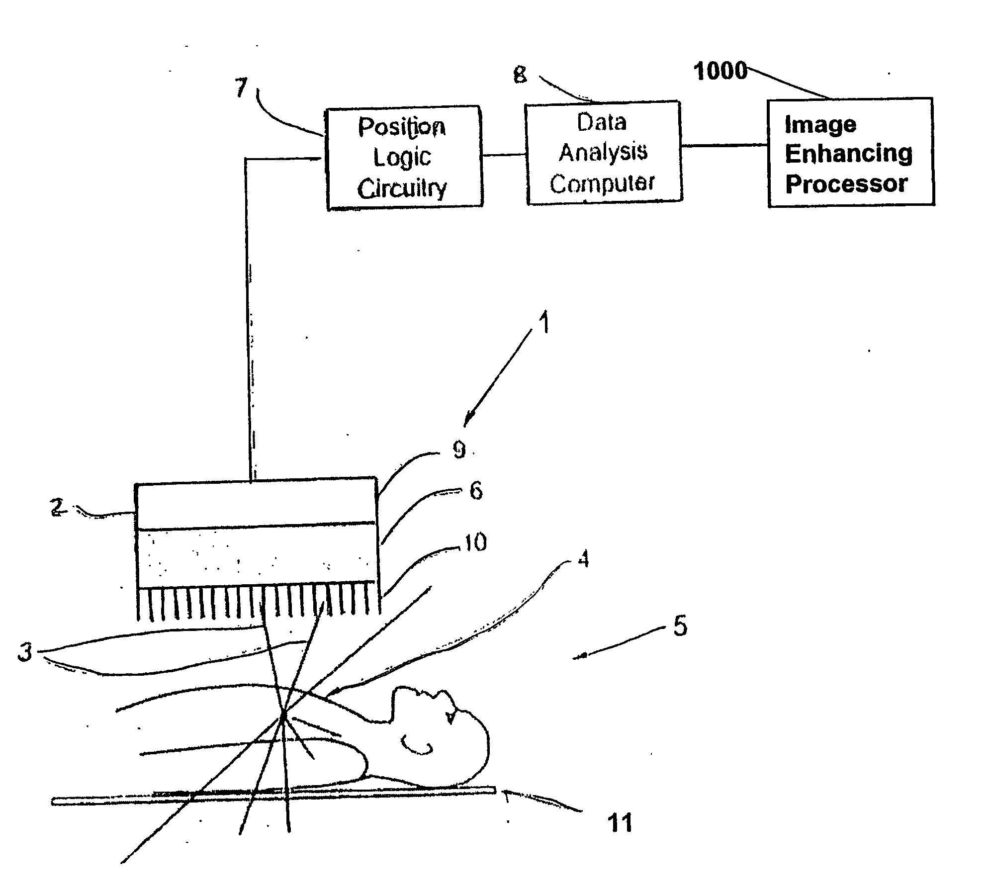 Enhanced Planar Single Photon Emission Imaging