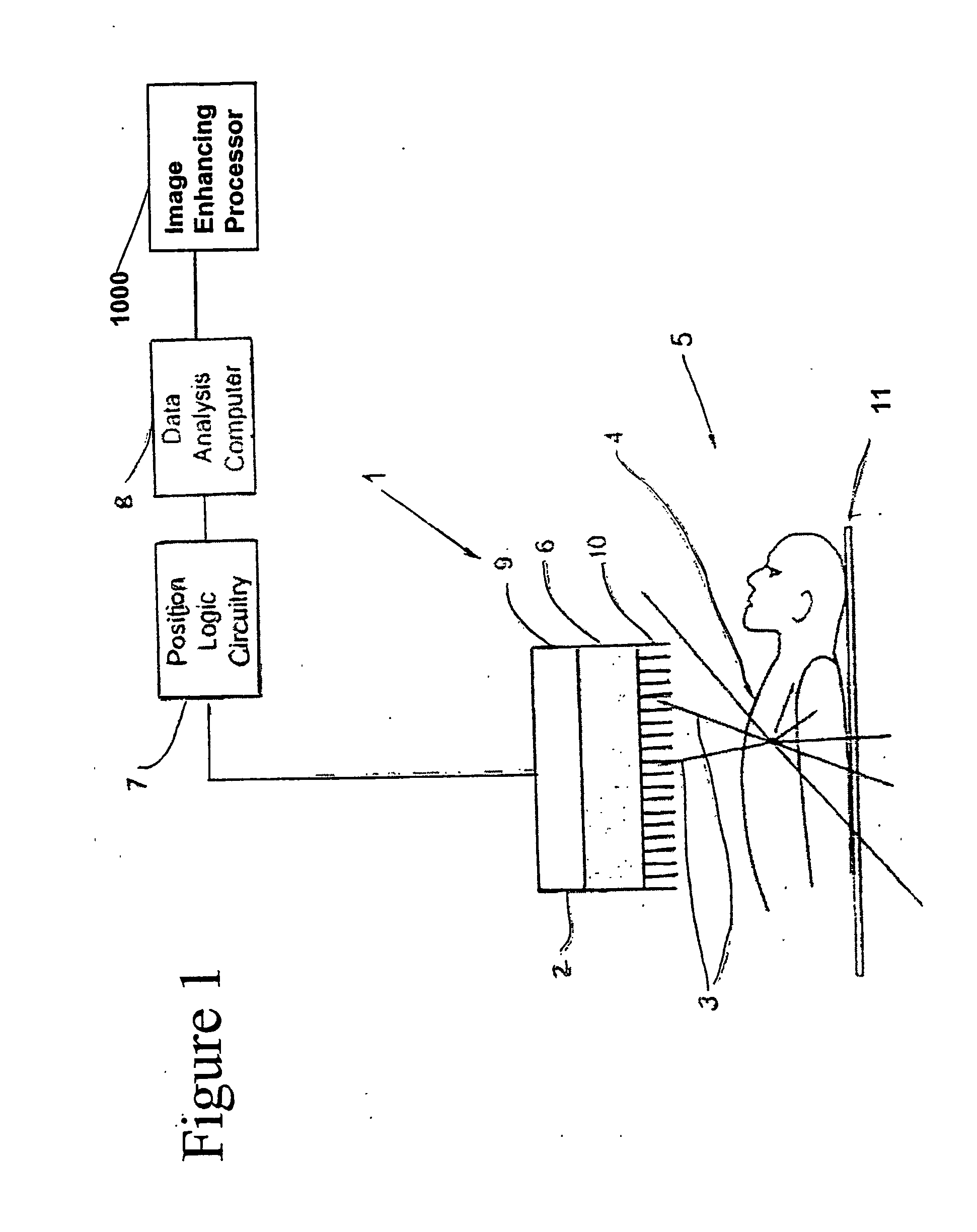 Enhanced Planar Single Photon Emission Imaging