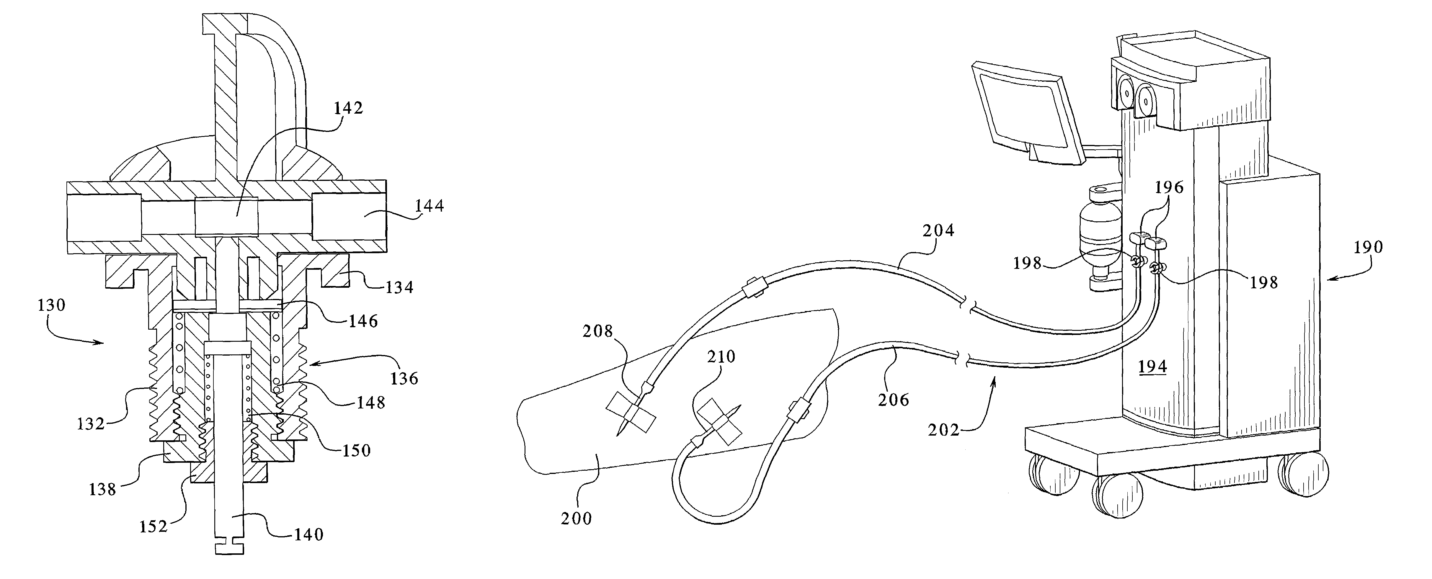 Access disconnection systems and methods