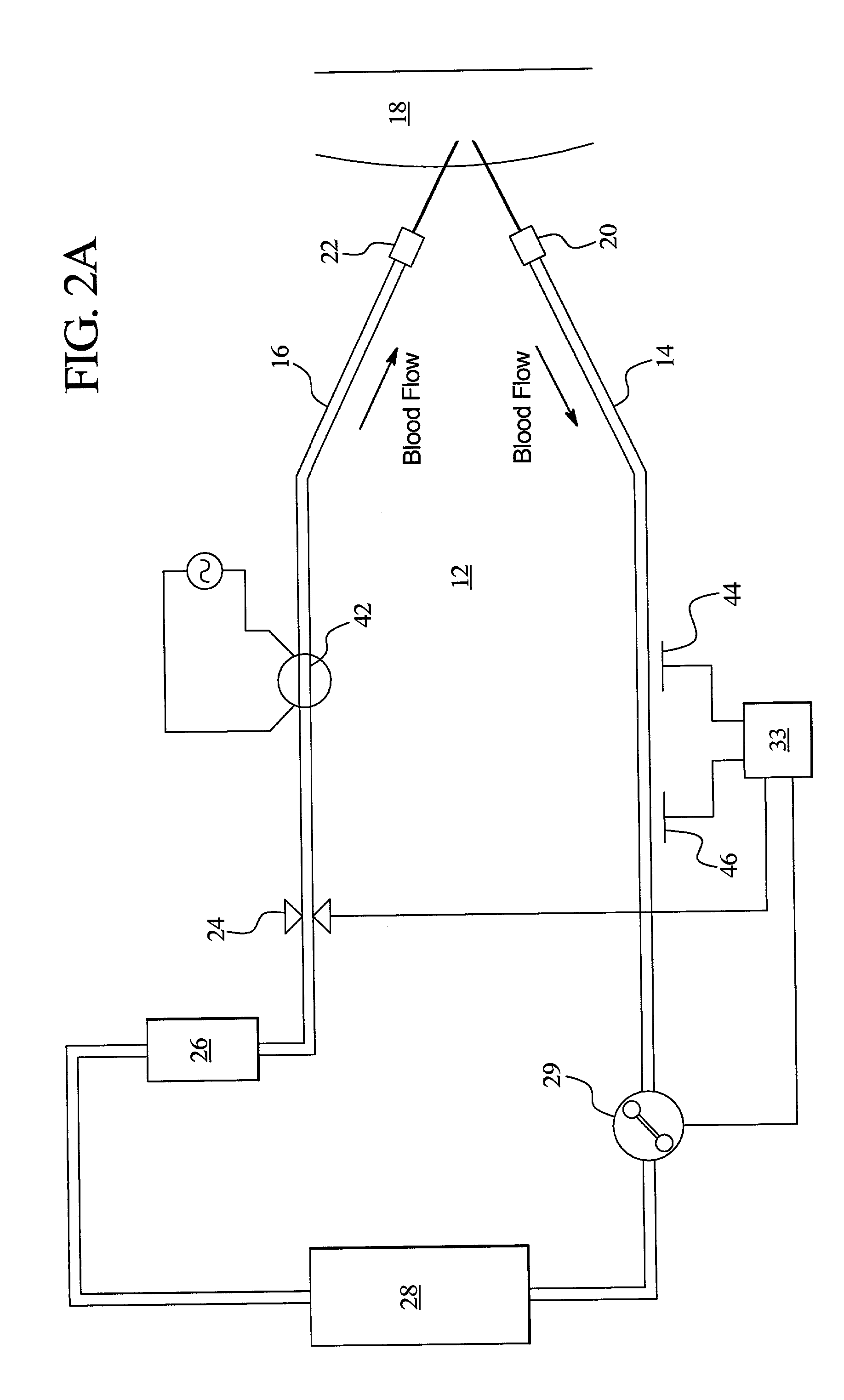 Access disconnection systems and methods