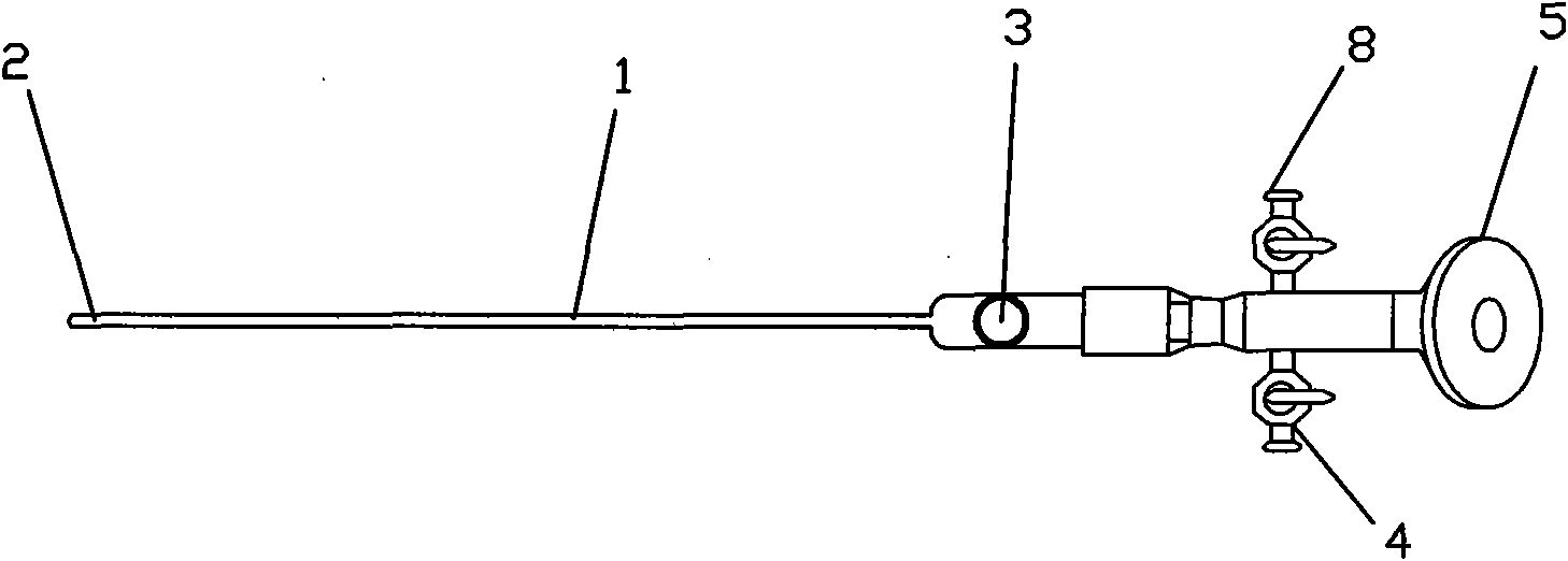 Choledochoscope for removing calculi