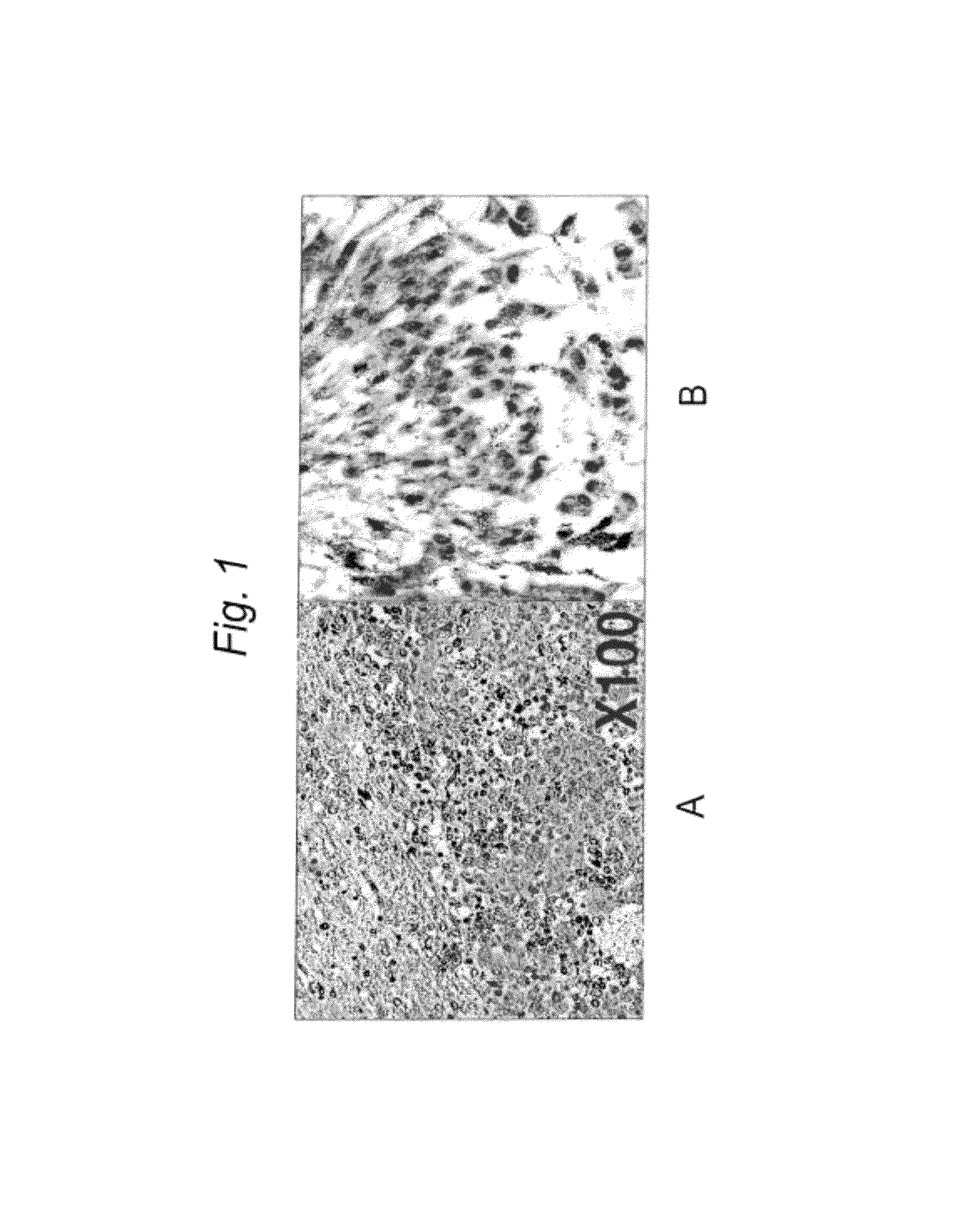 Synthetic LDL as targeted drug delivery vehicle