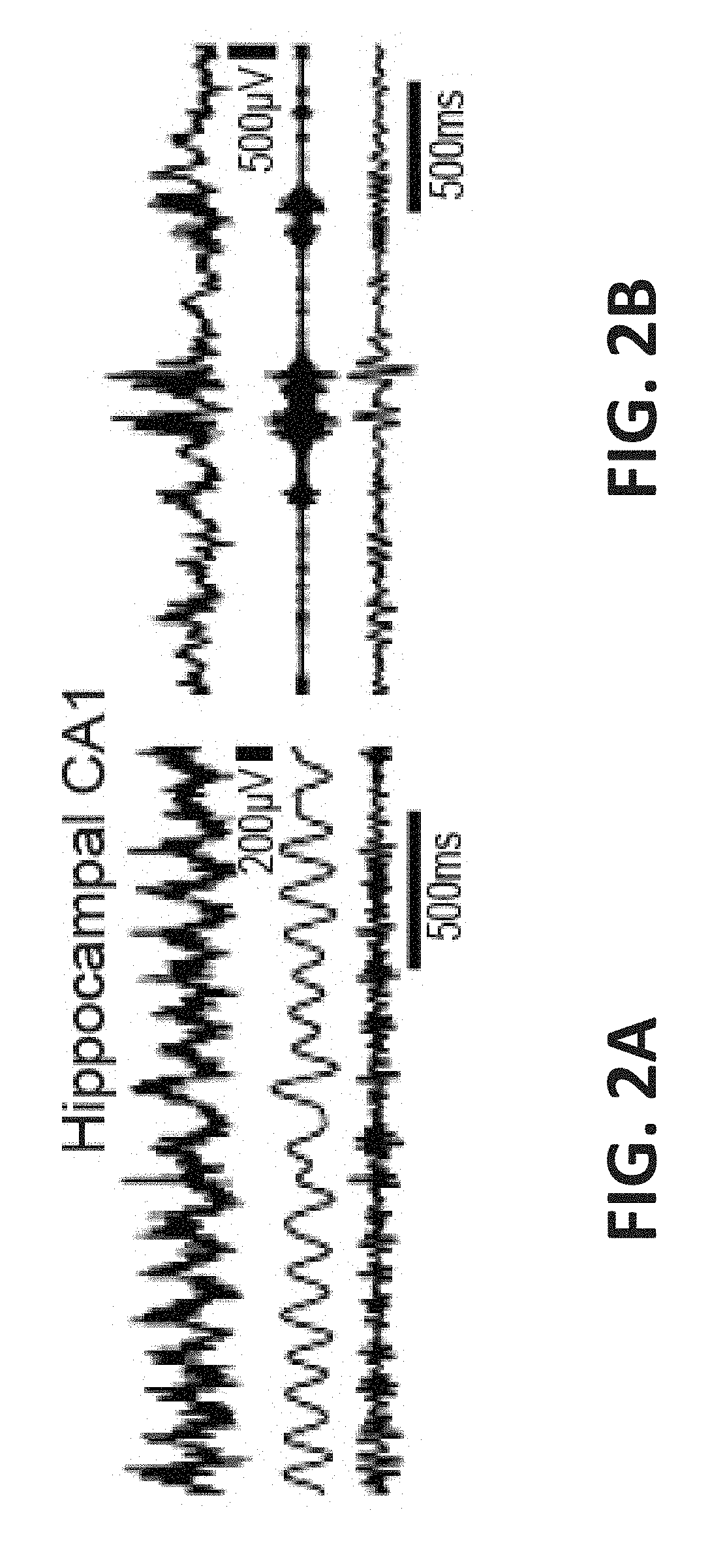 Systems and methods for treating dementia