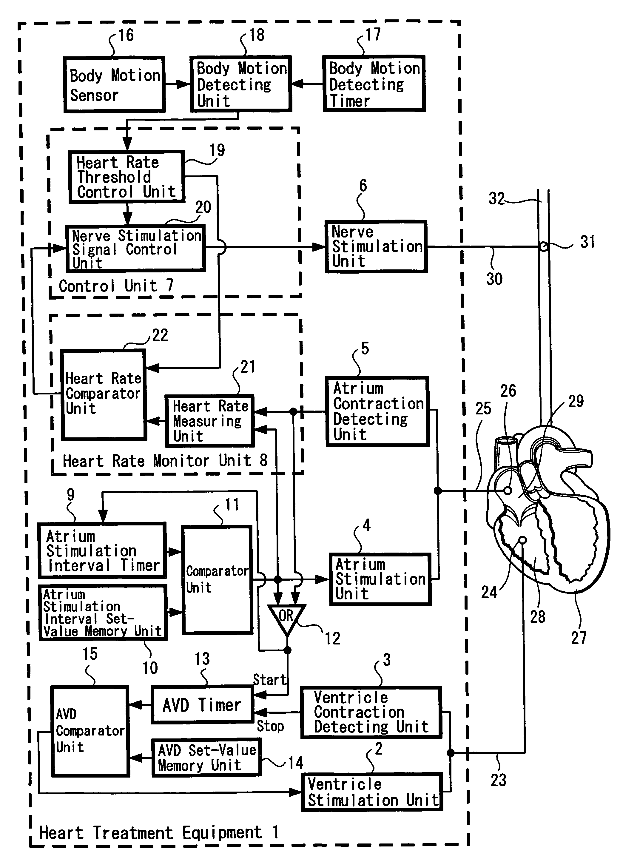 Heart treatment equipment and heart treatment method