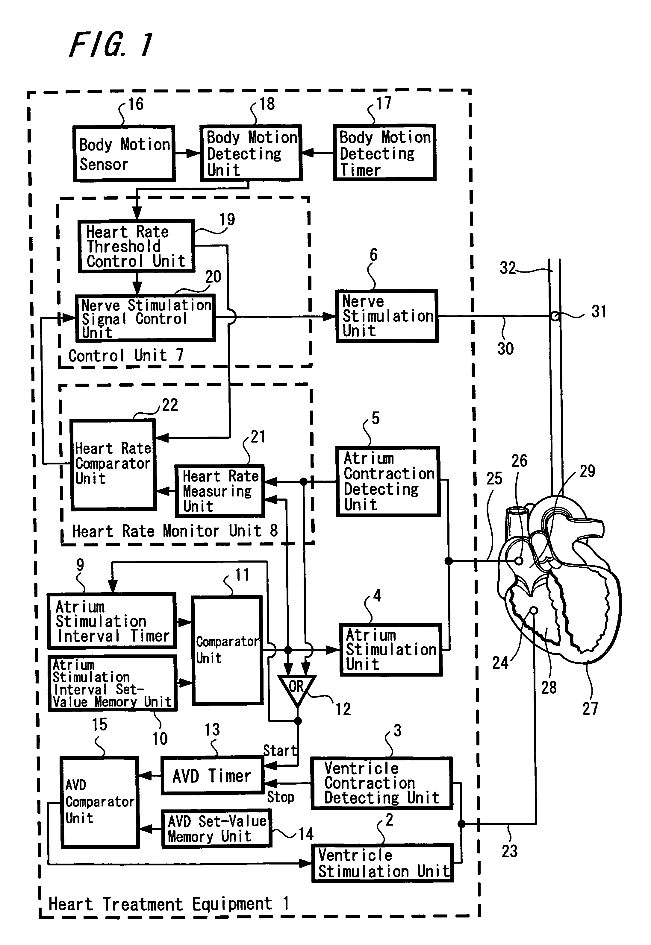 Heart treatment equipment and heart treatment method