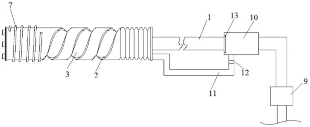 Calculus removing device for department of hepatobiliary surgery