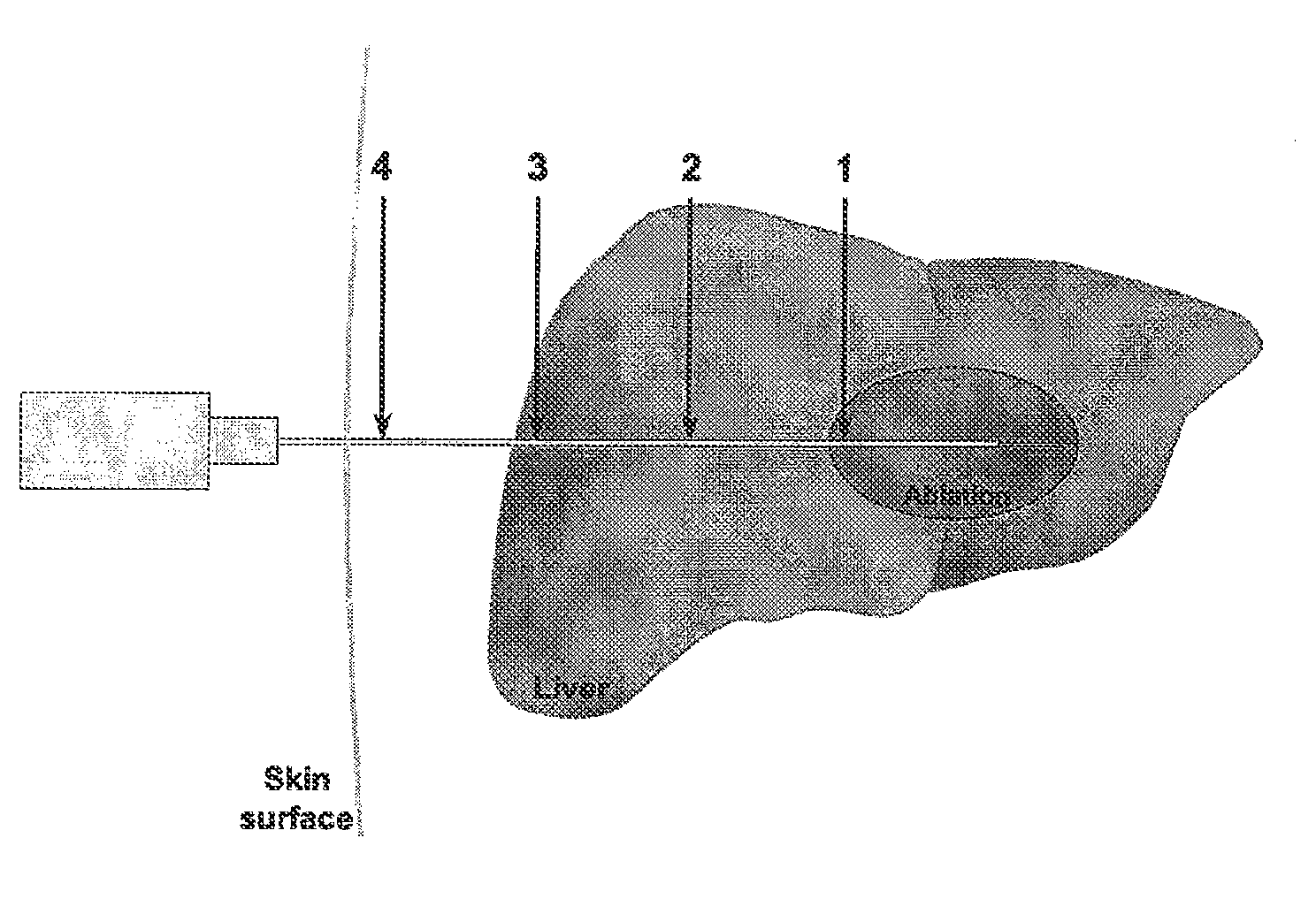 Energy delivery systems and uses thereof