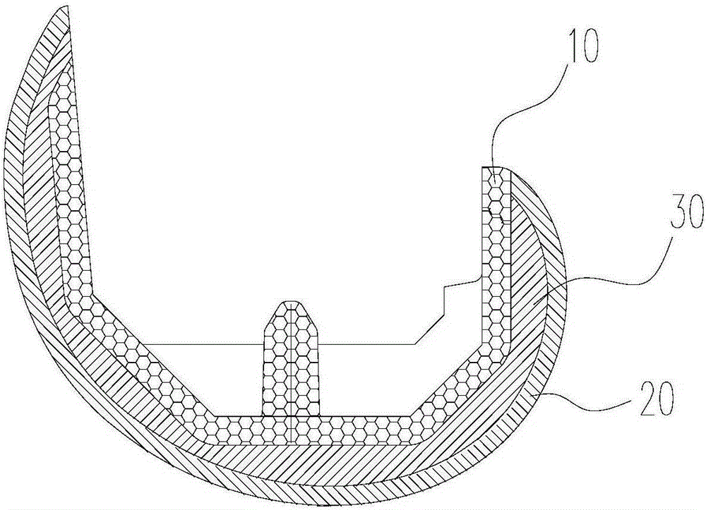 Double-metal prosthesis component