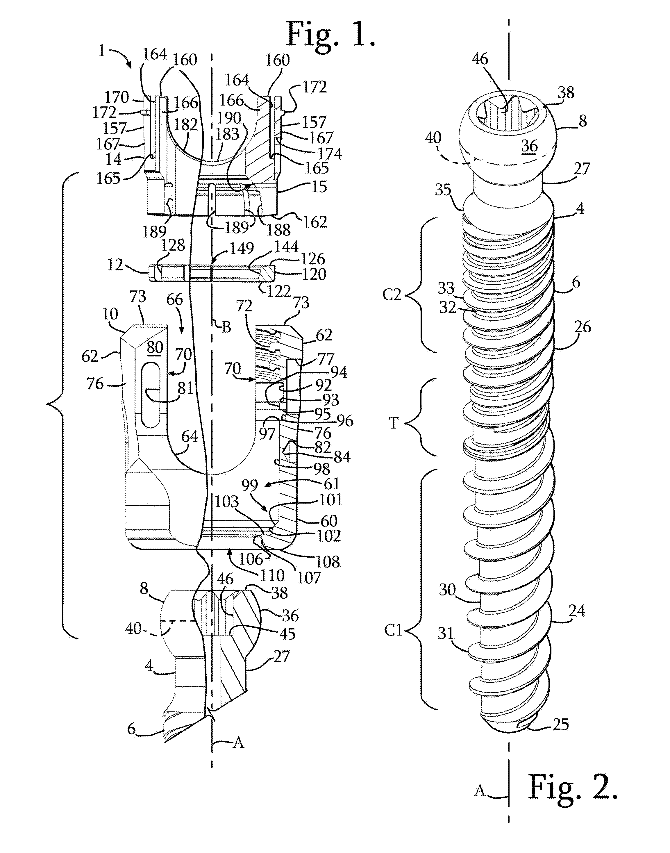 Polyaxial bone anchor with pop-on multi-thread shank, some with diametric interference fit inserts