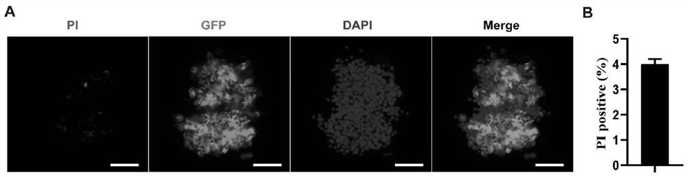 Applications of adiponectin modified islet cells in improvement or enhancement of islet transplantation