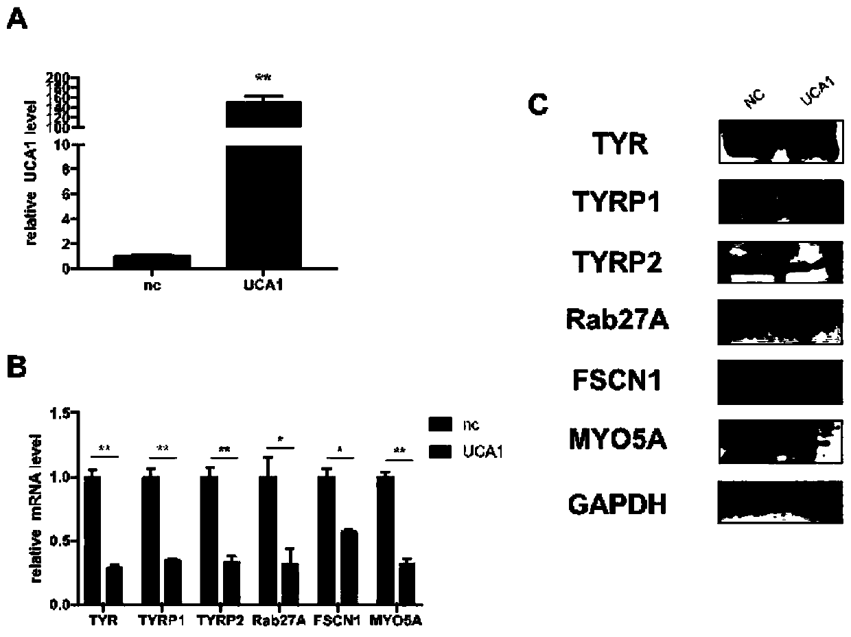 Application of uca1 as a target site in the preparation of drugs for the treatment of hyperpigmented skin diseases