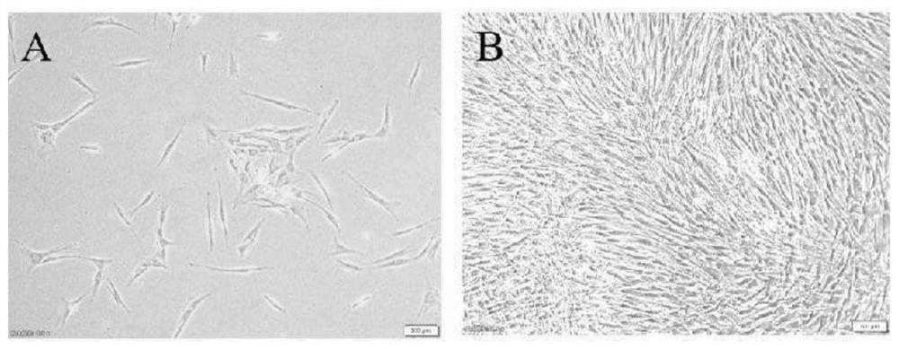 Preparation method and application of dental pulp and dentin complex