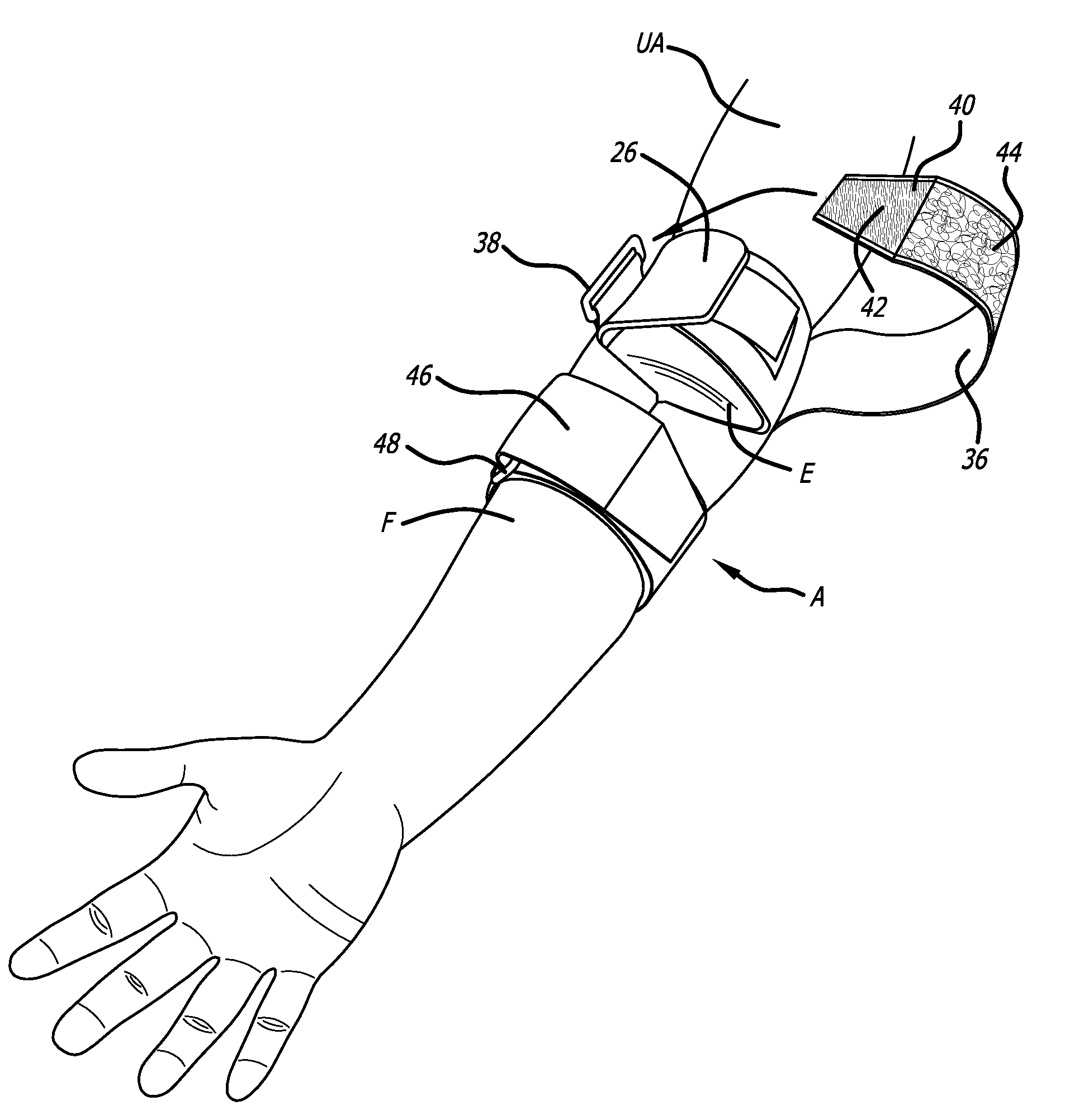 Elbow brace for preventing or attenuating tennis elbow