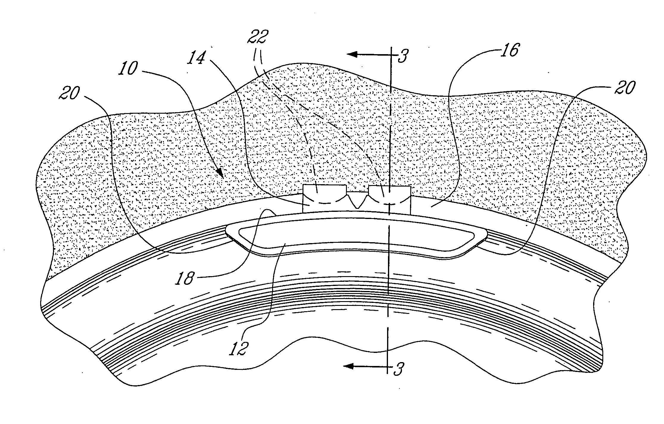 Zinc based material wheel balancing weight