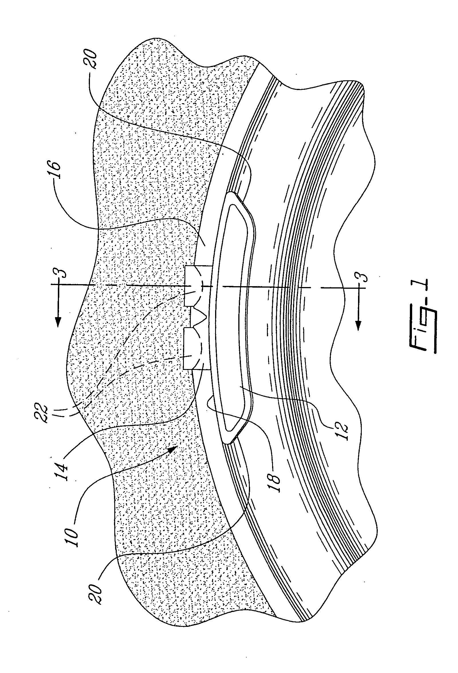 Zinc based material wheel balancing weight