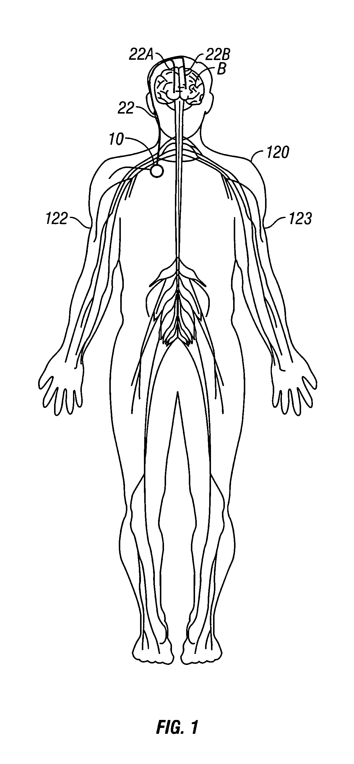 Variation of neural-stimulation parameters