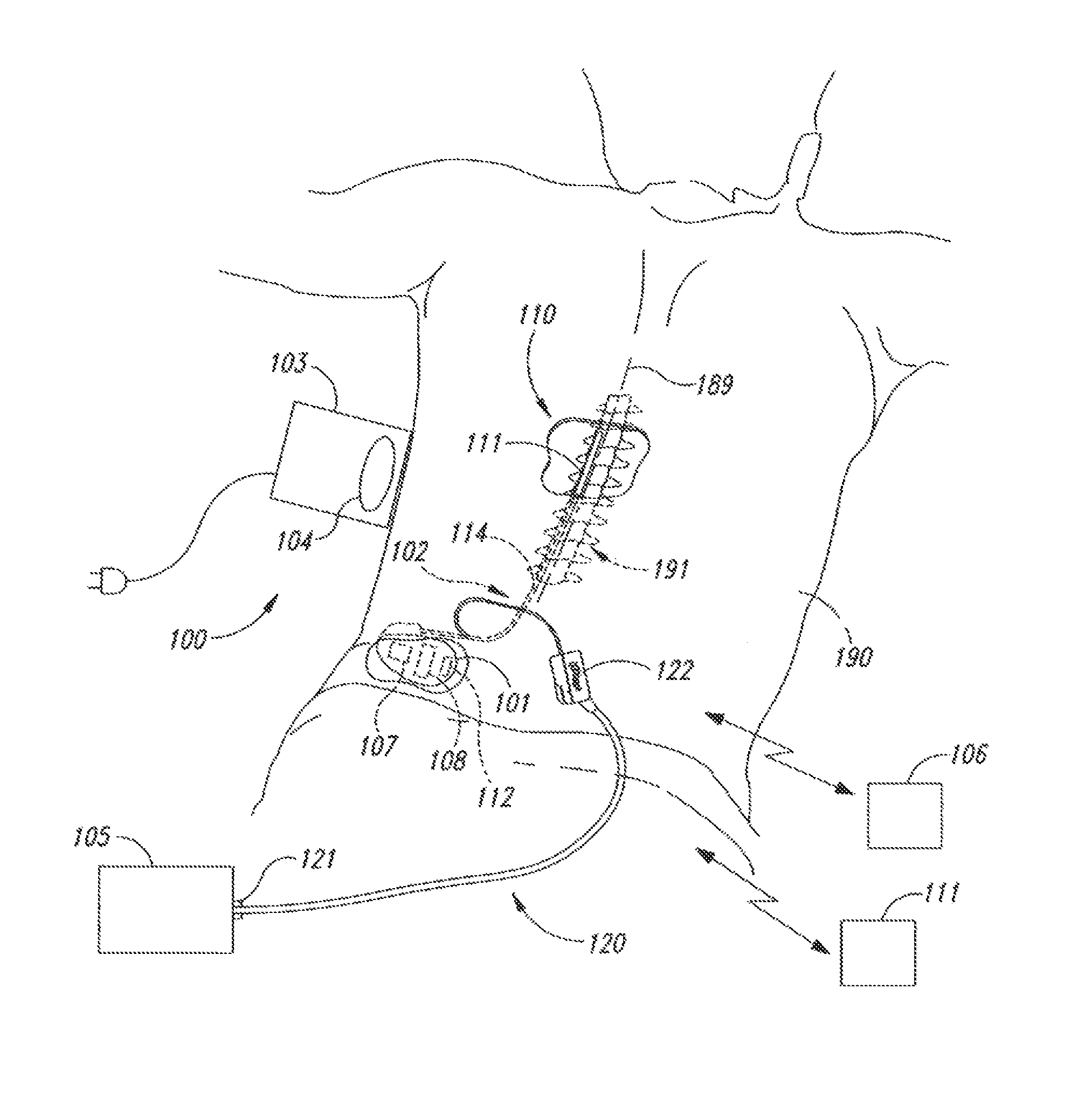 Selective high frequency spinal cord modulation for inhibiting pain with reduced side effects, and associated systems and methods