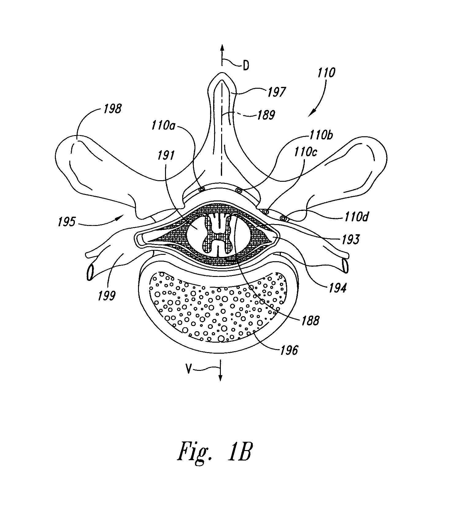 Selective high frequency spinal cord modulation for inhibiting pain with reduced side effects, and associated systems and methods