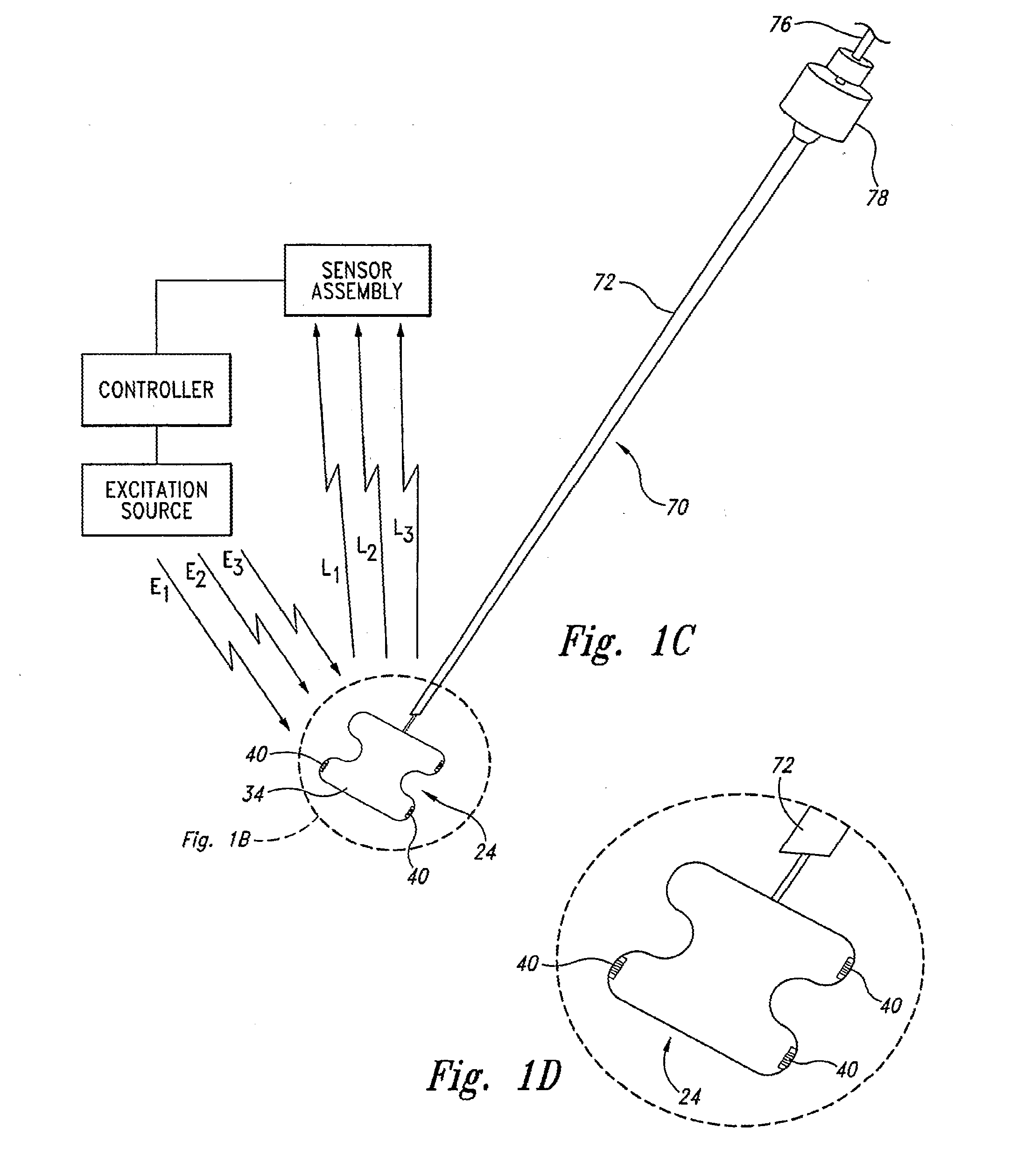 Apparatus and methods for using an electromagnetic transponder in orthopedic procedures