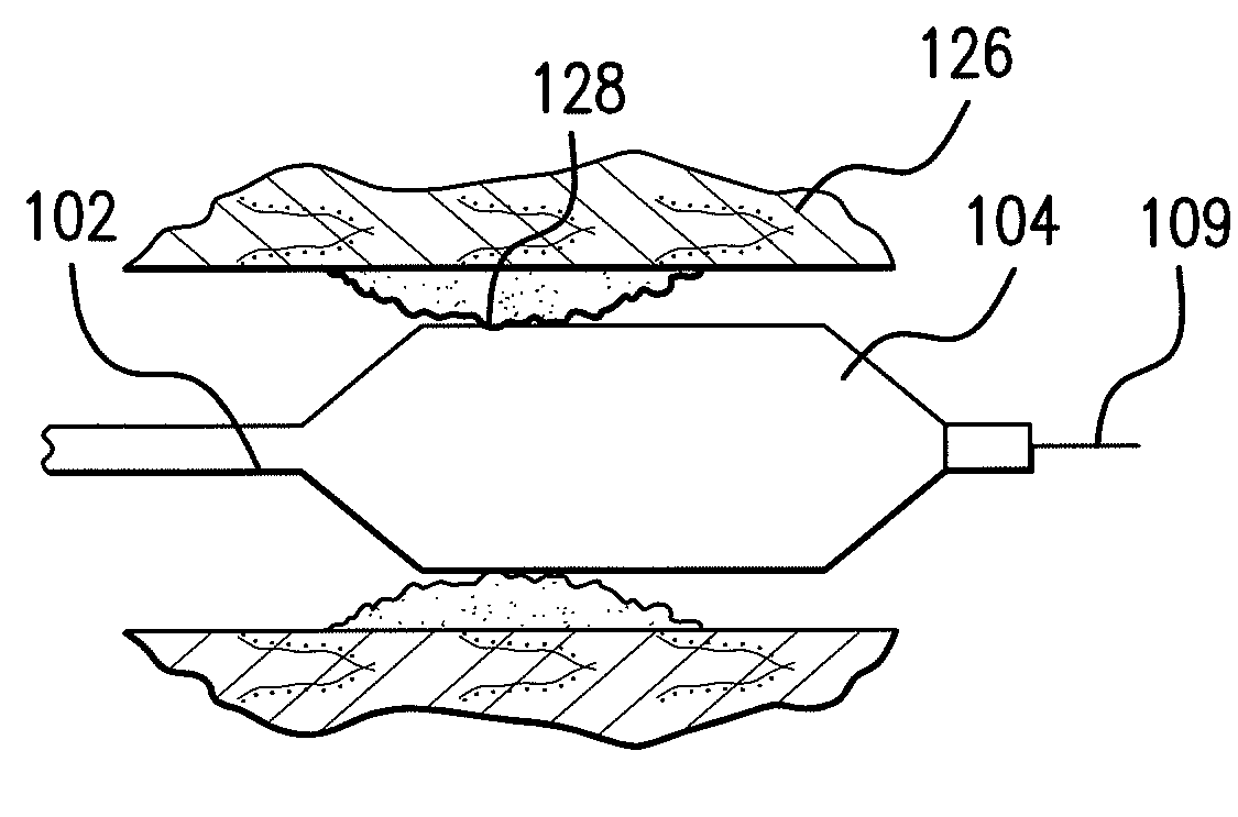 Expandable Member Formed Of A Fibrous Matrix For Intraluminal Drug Delivery