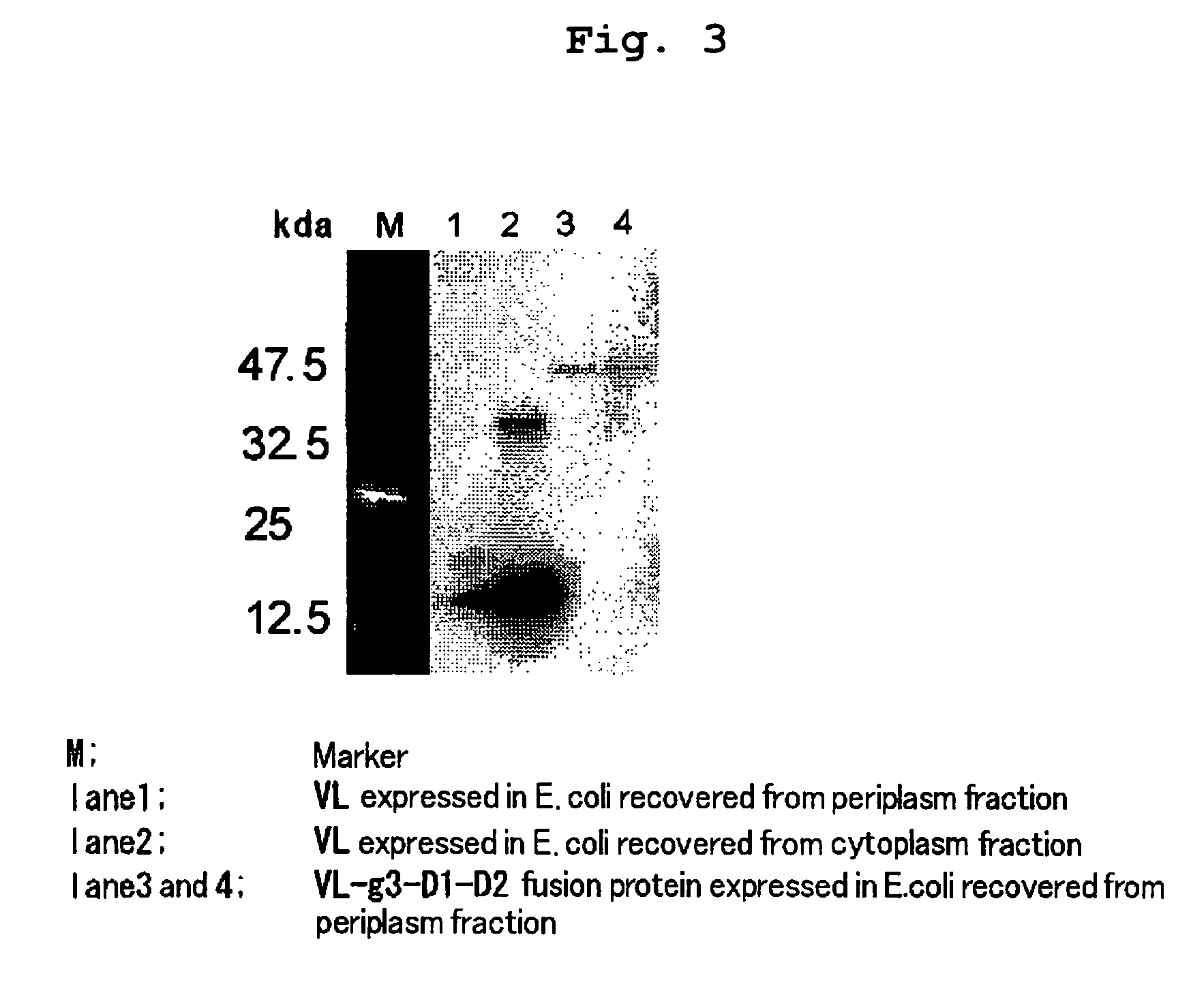 Human anti-amyloid β peptide antibody and fragment of said antibody