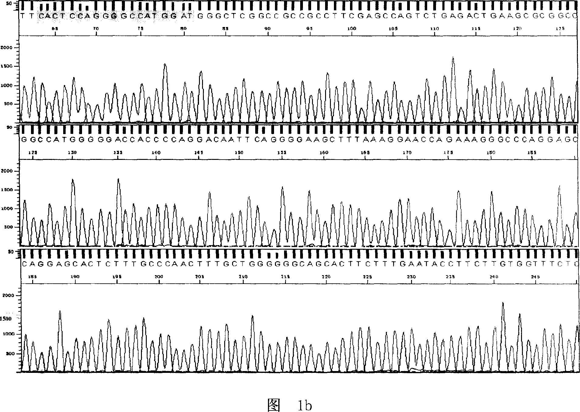 Tumor correlated albumen, coding gene and application thereof